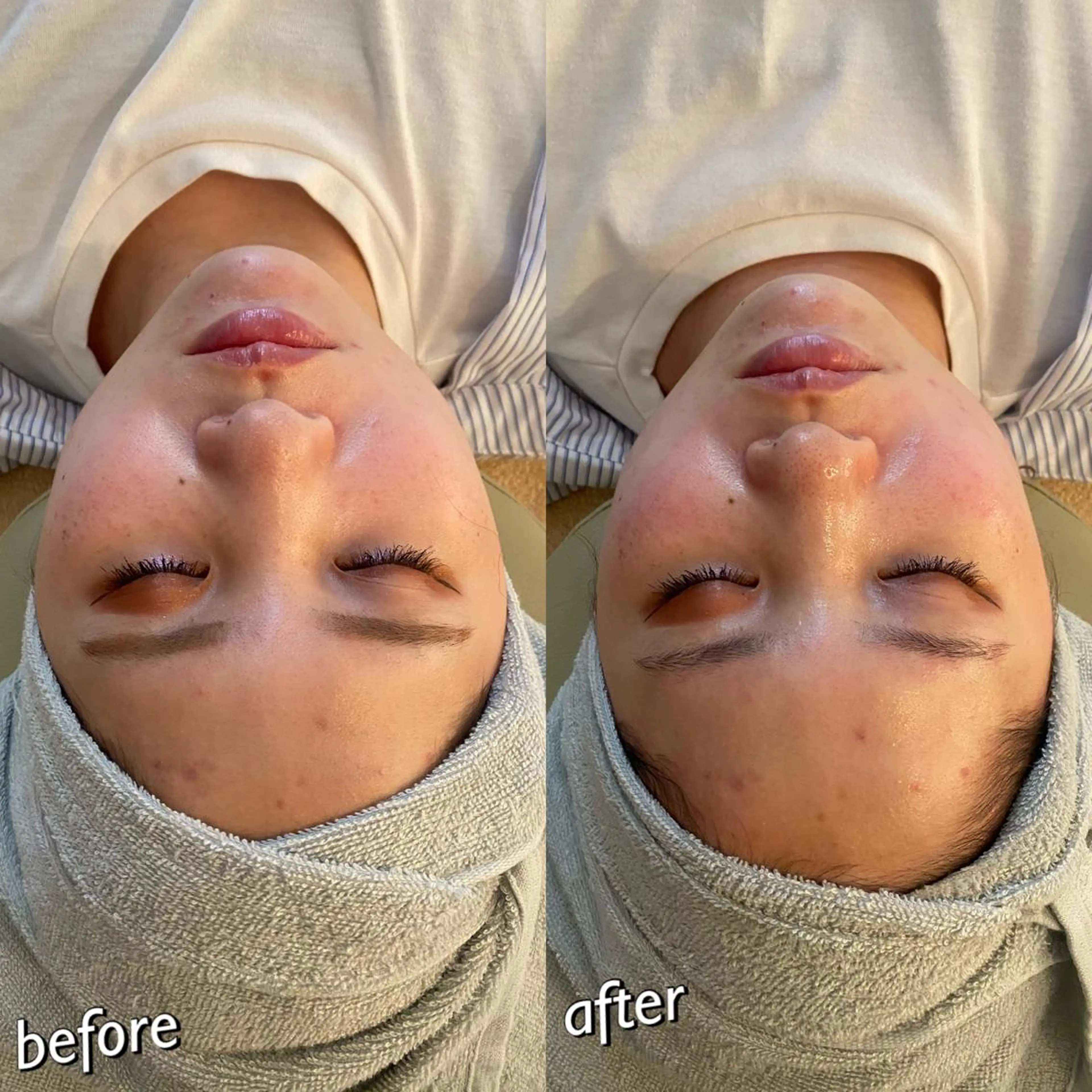 うなじ脱毛/美肌脱毛 LABELのエステ・リラクイメージ