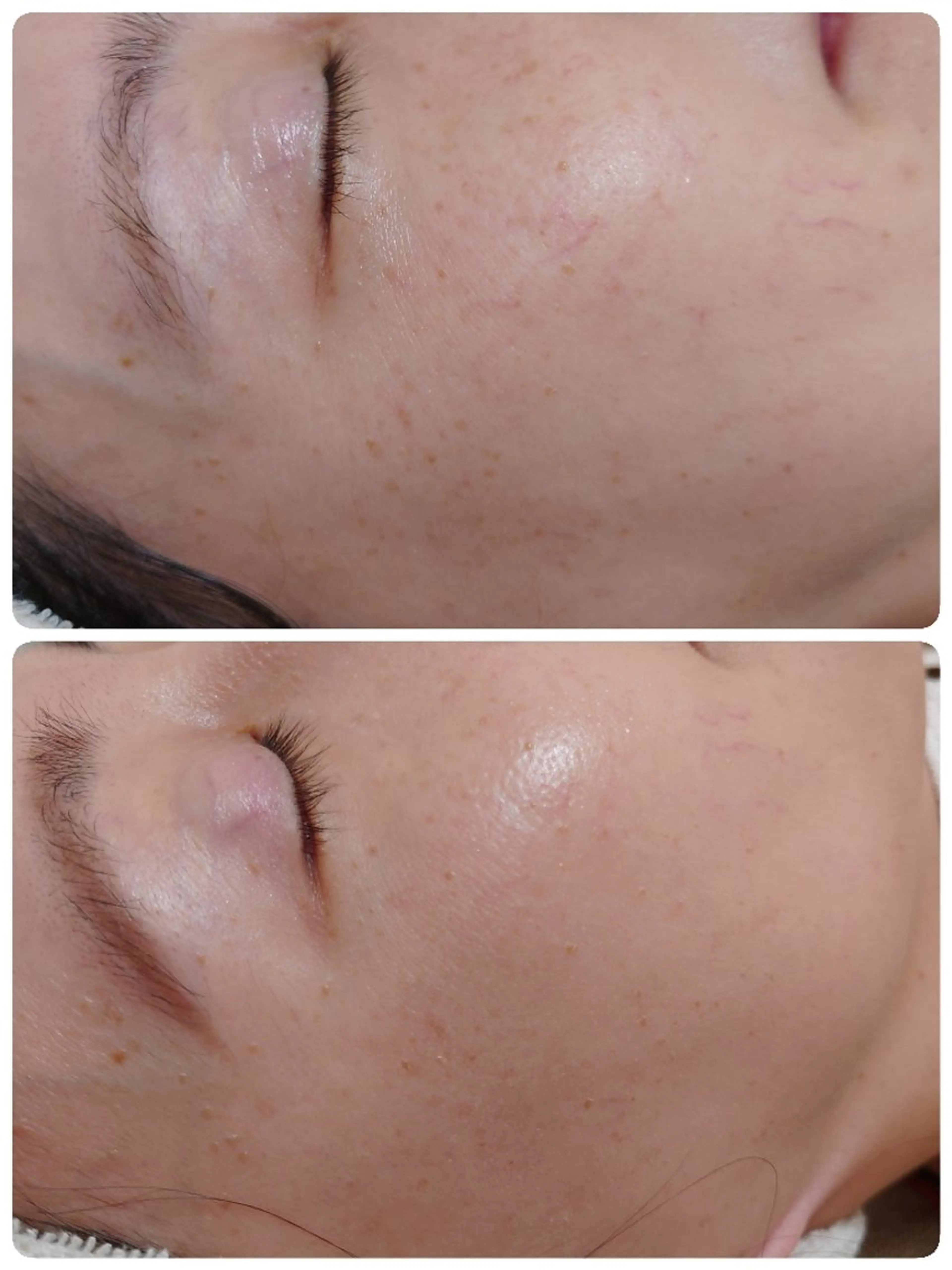 エステ Abe Yukaのエステ・リラクイメージ