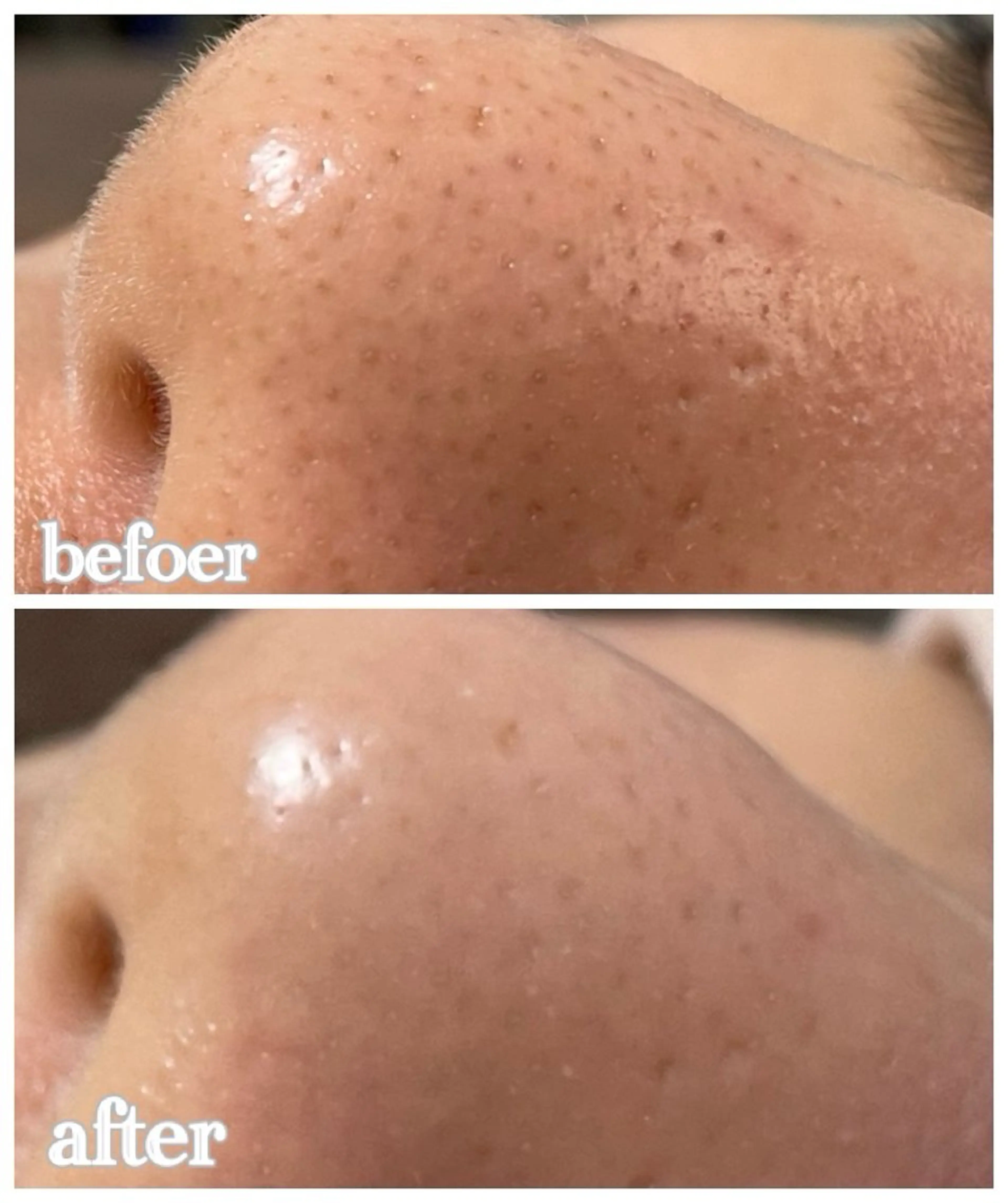 エステルーム ラティア所属・今井 登美子のエステ・リラクイメージ