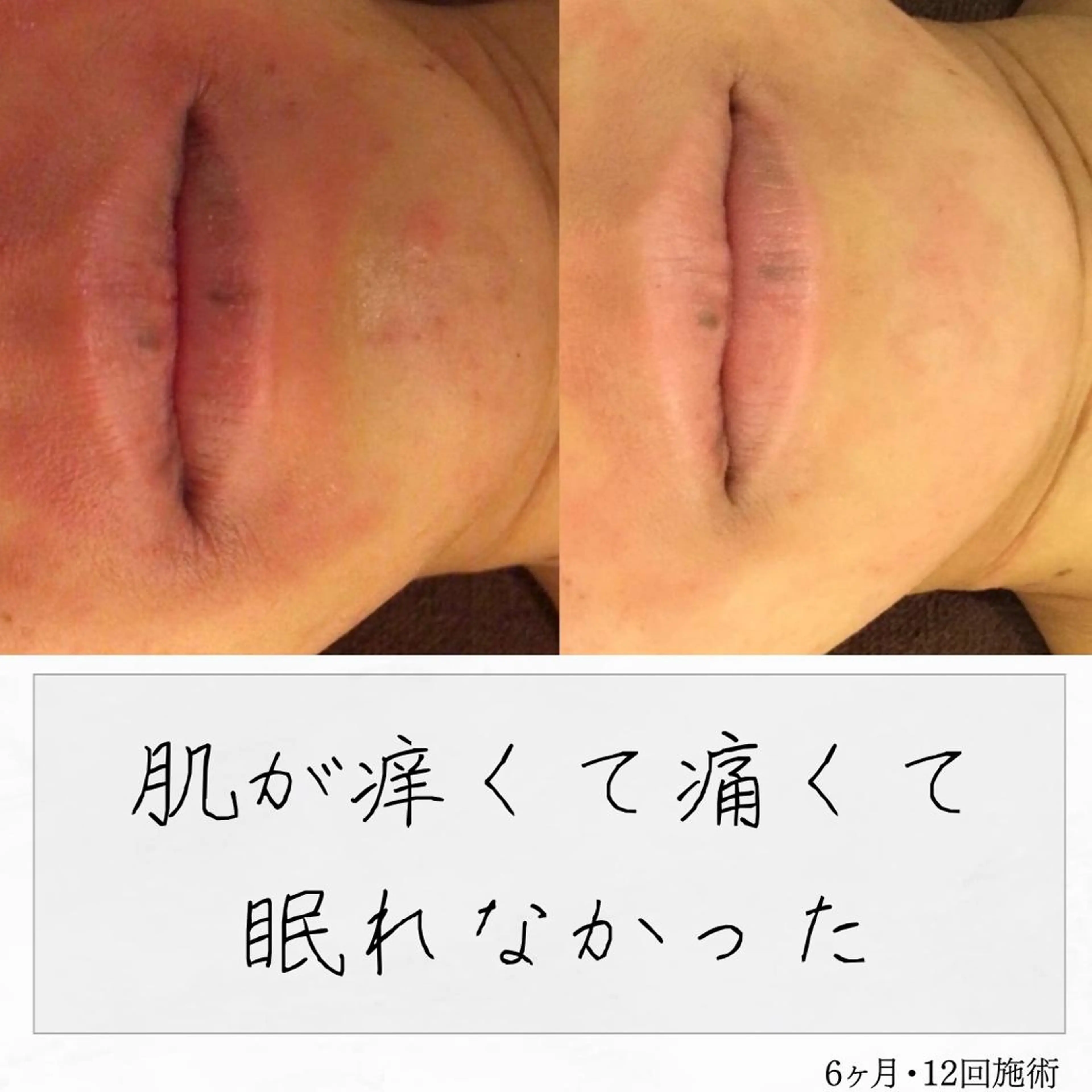 ニキビ経験者が施術 する専門サロン🌻のエステ・リラクイメージ