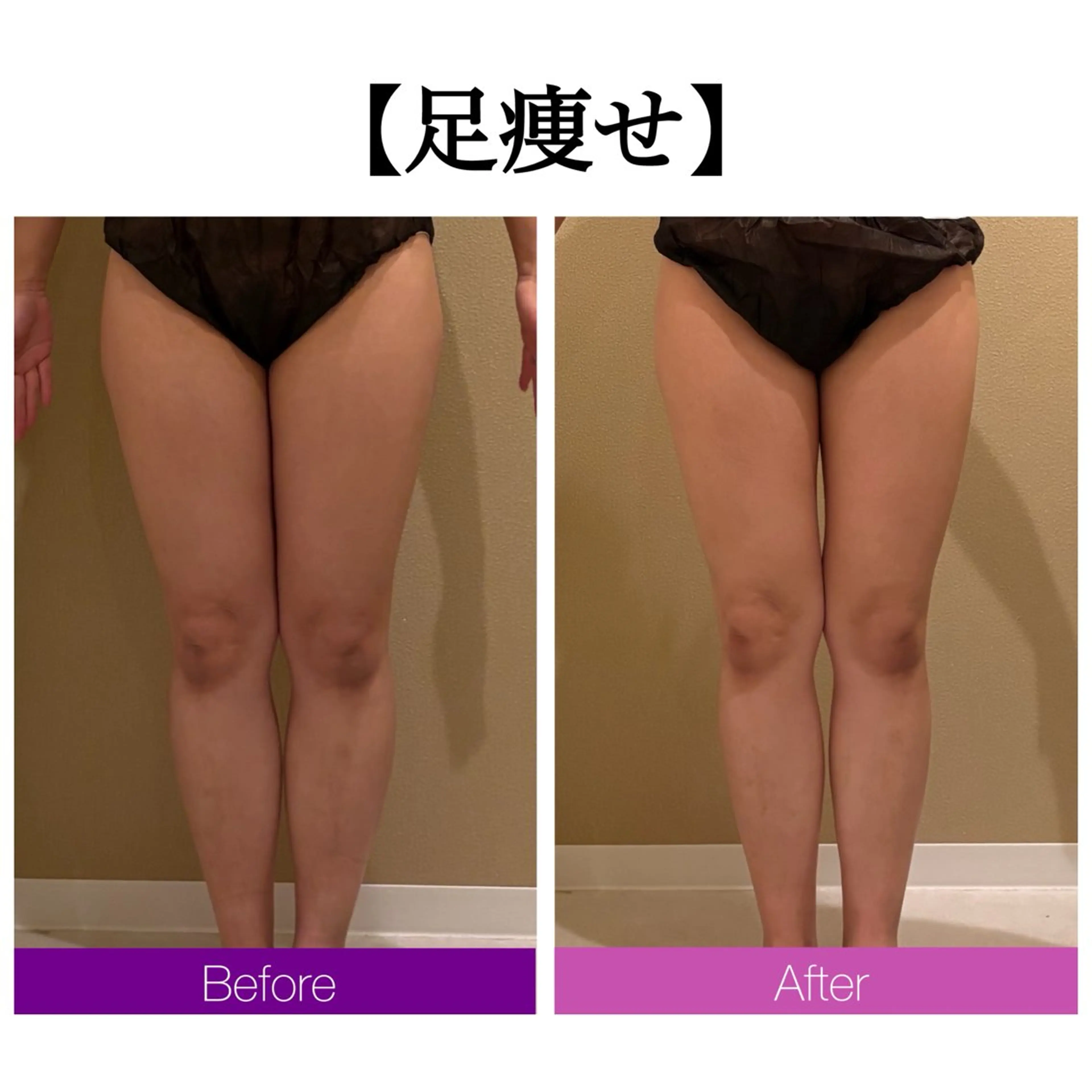 小顔コルギ ☆表参道/外苑前のエステ・リラクイメージ