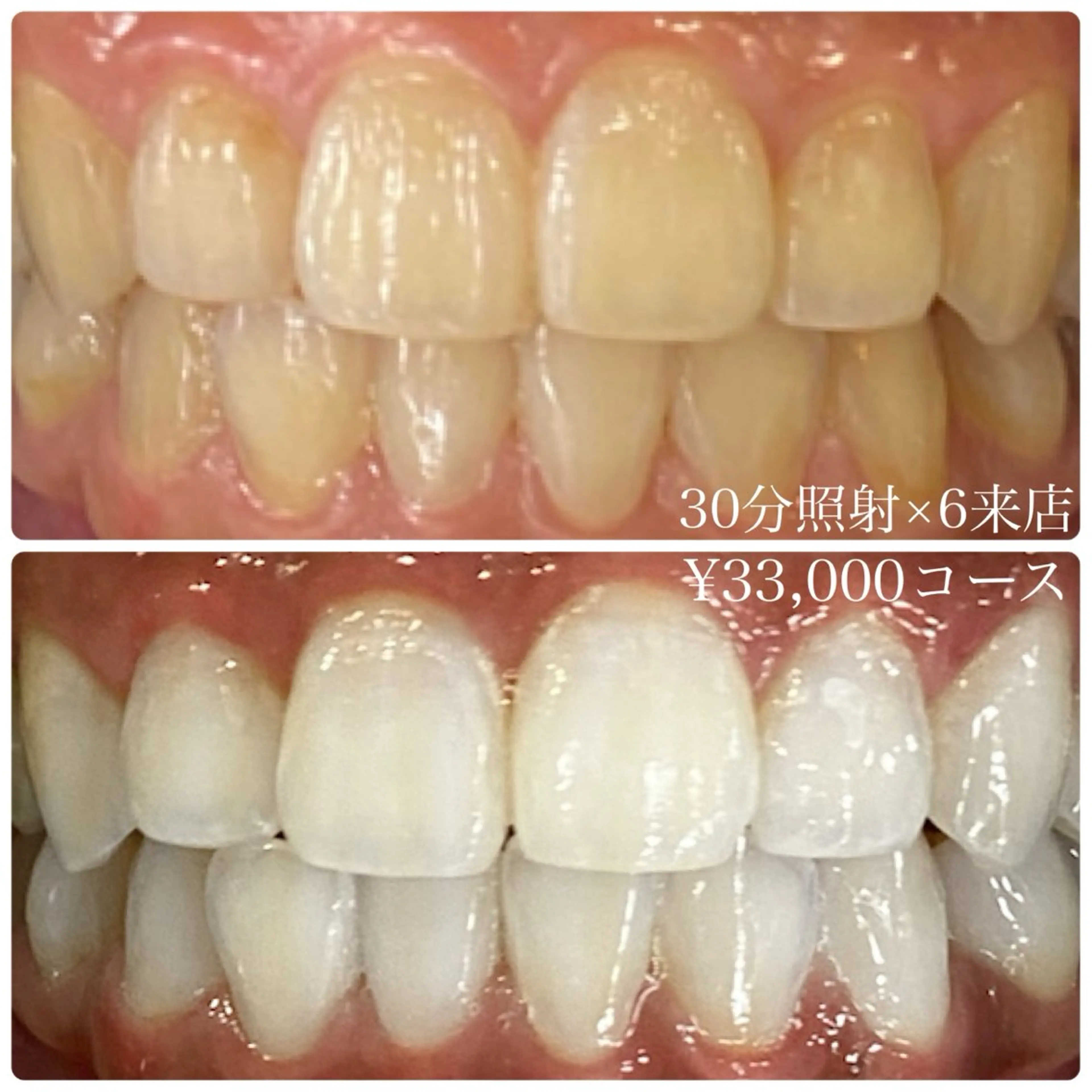 メンズ ホワイトニング ルーム　川崎店のその他イメージ