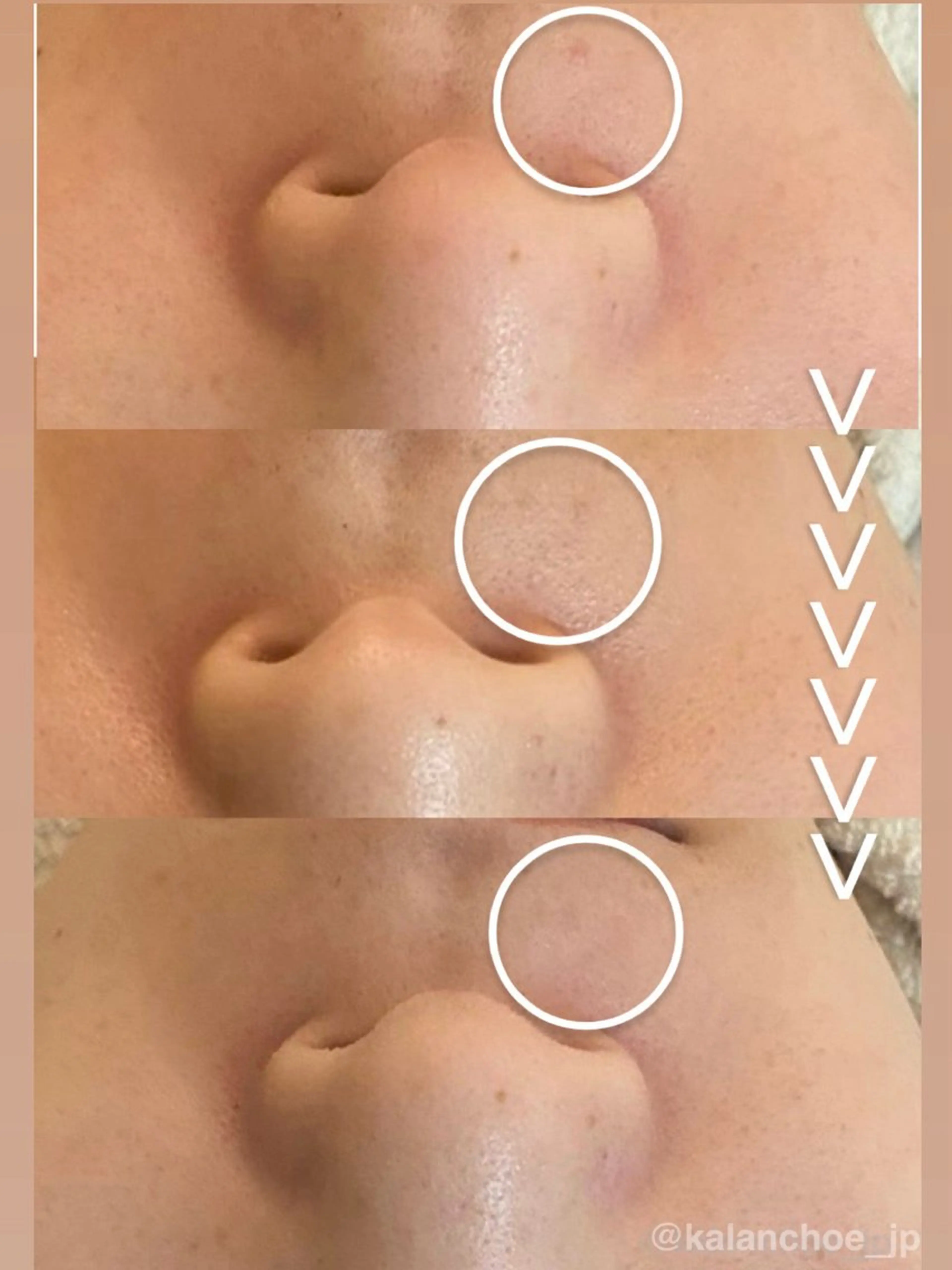 エステ 肌質改善 KALANCHOEのエステ・リラクイメージ