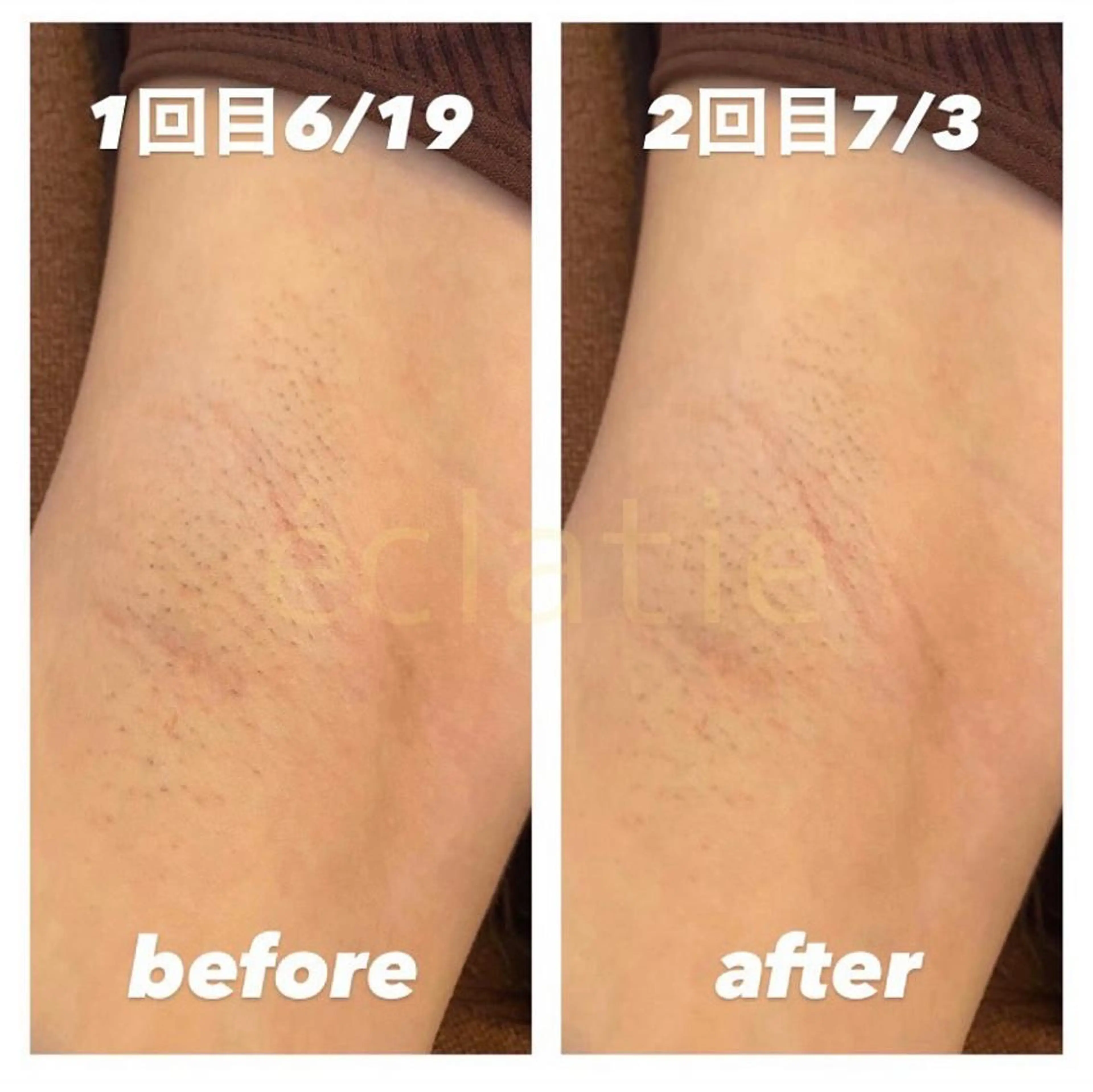 横井 愛奈のエステ・リラクイメージ