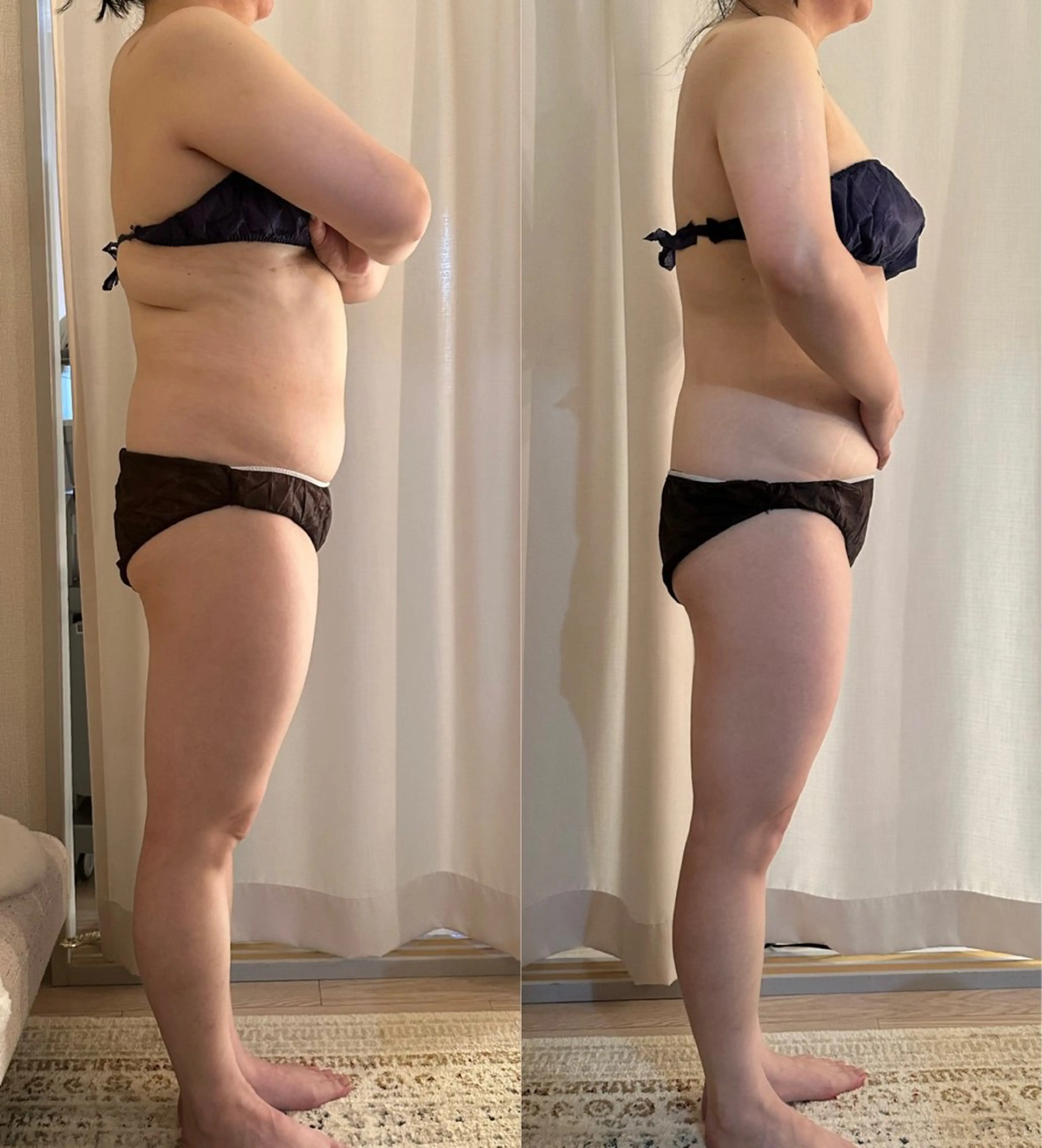 美容鍼WINBACK サロンRemeのエステ・リラクイメージ