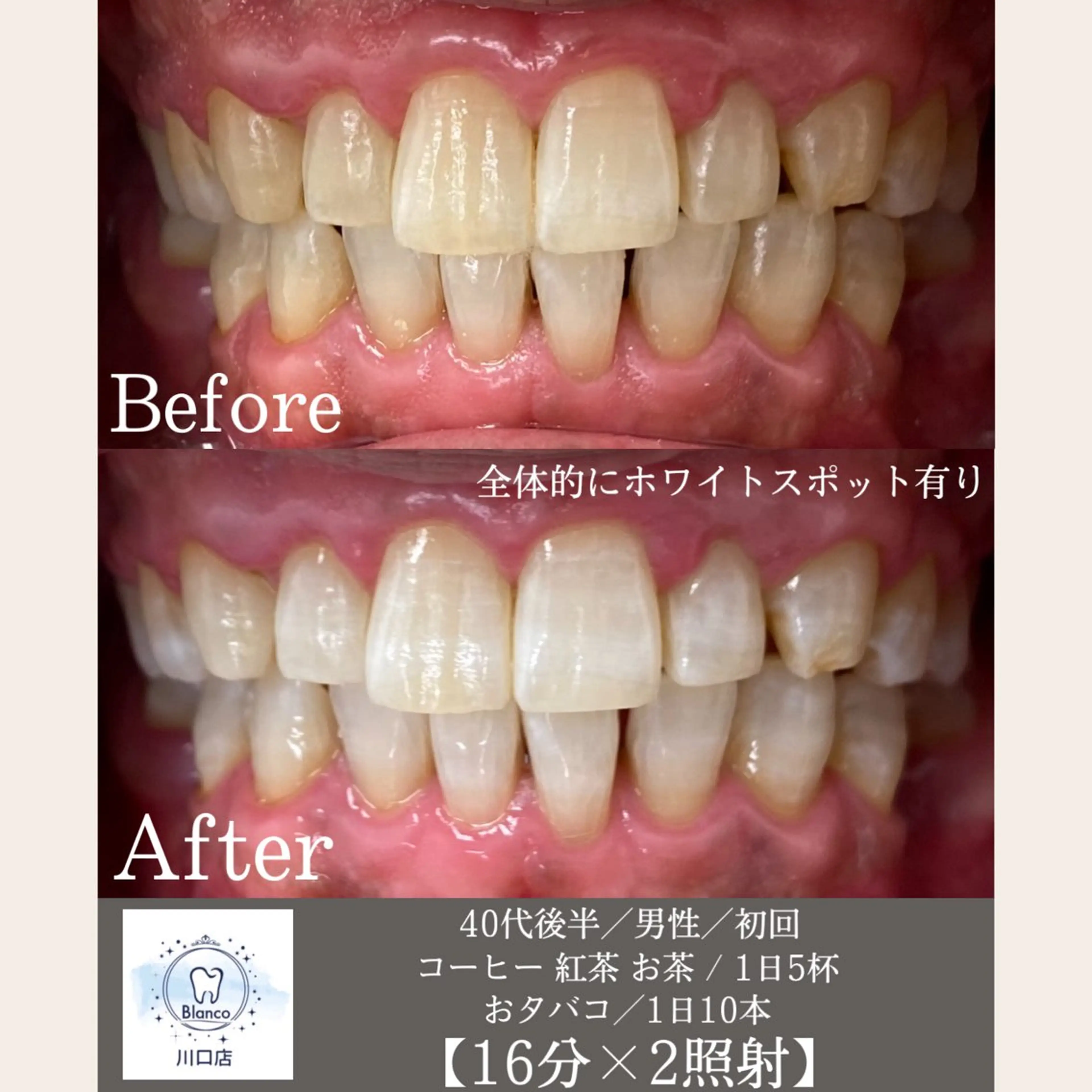 その他 Blanco 川口駅前店のその他イメージ