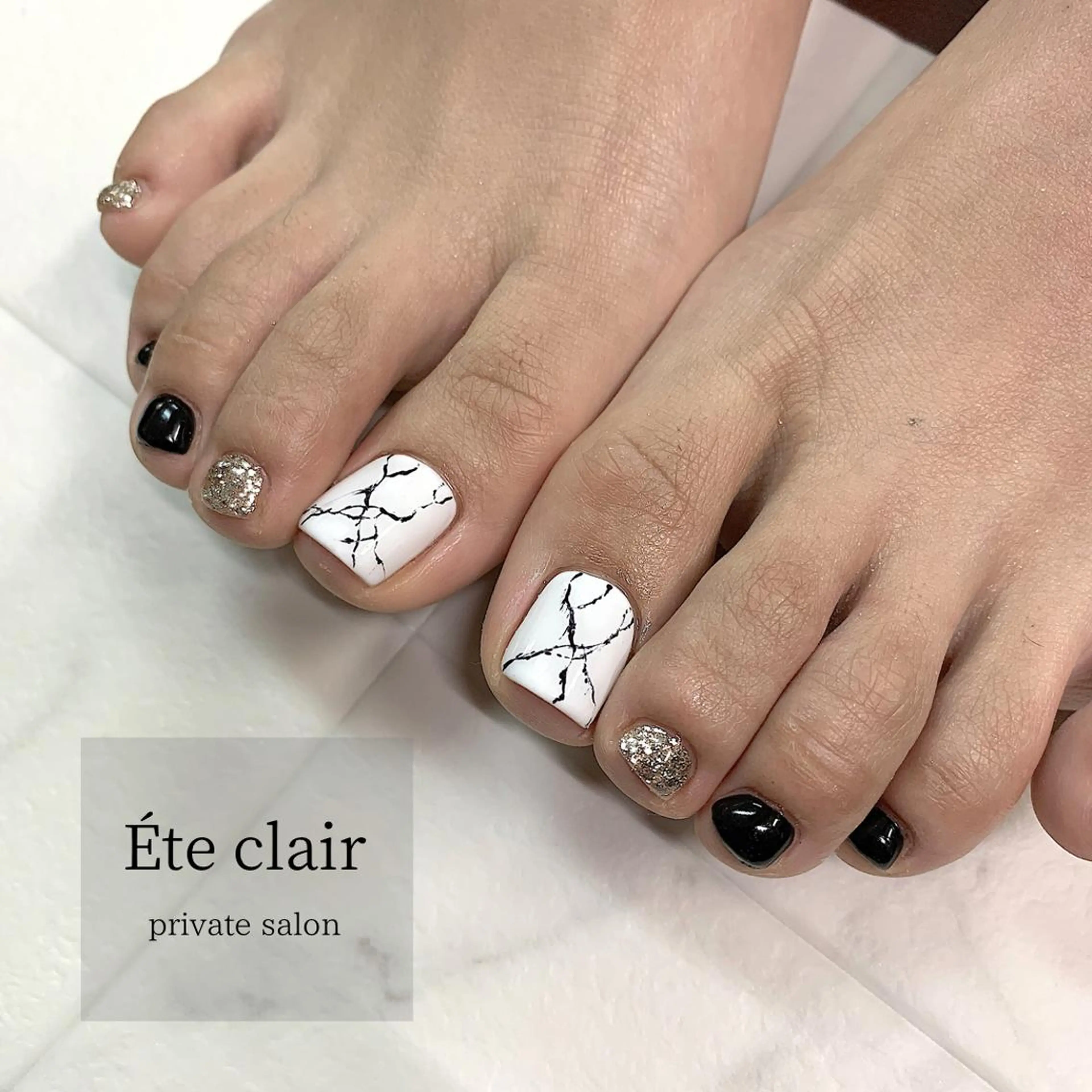 親指２本アートコースの写真