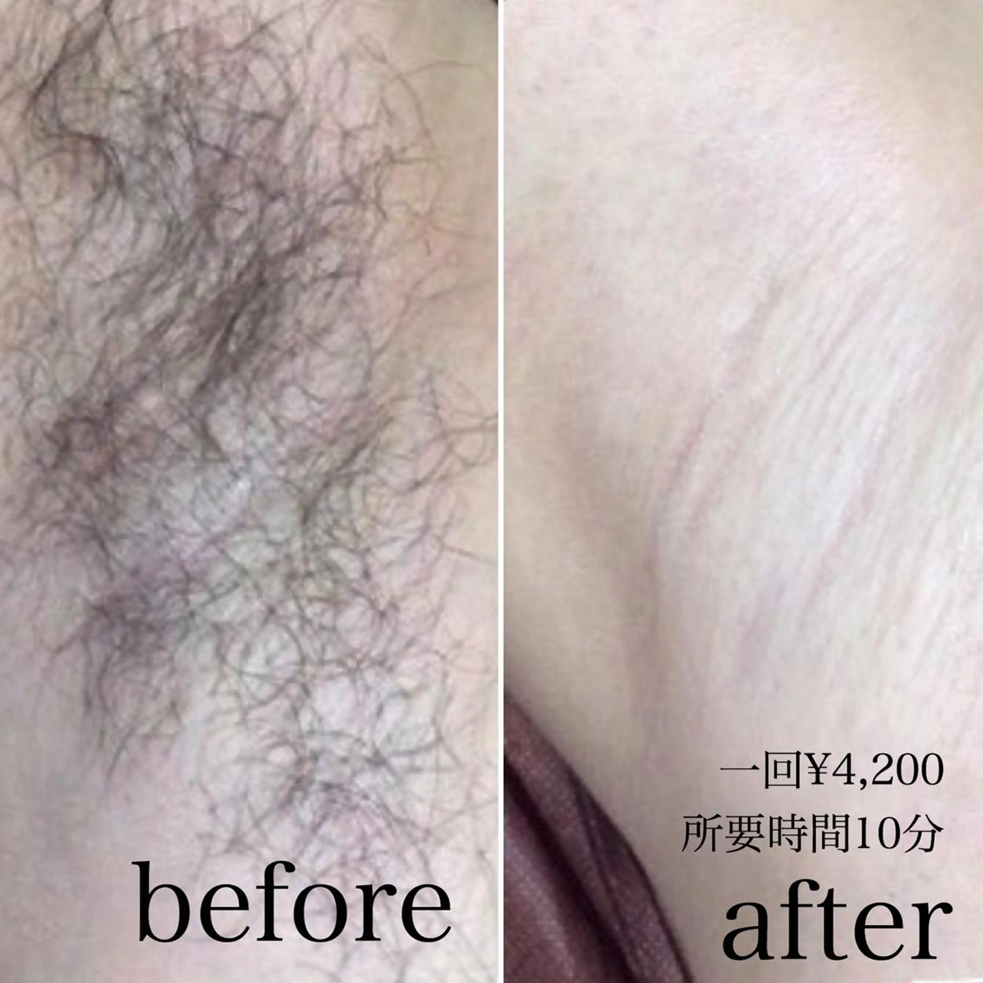 calon hair所属・men's calonのエステ・リラクイメージ