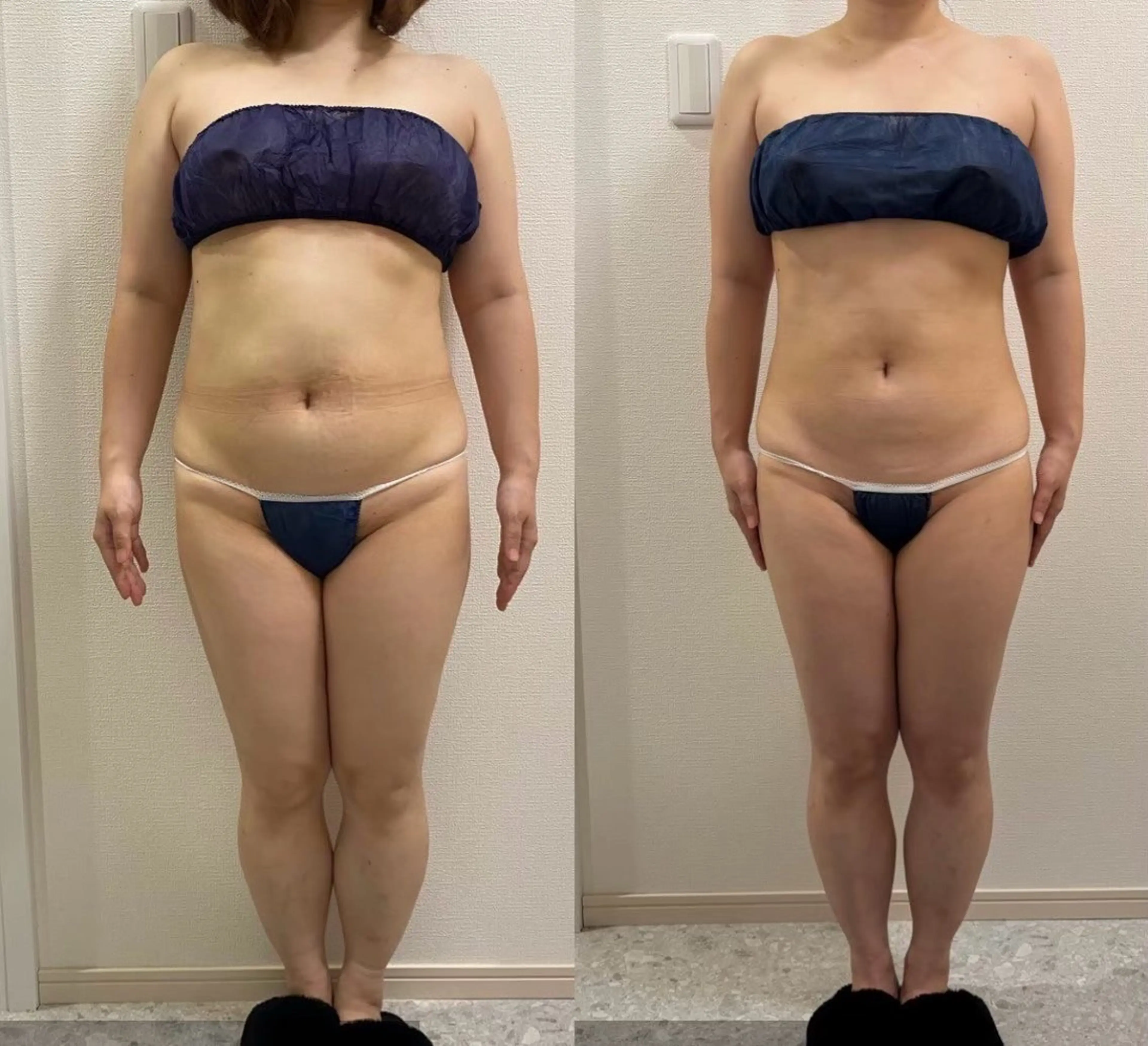 エステ 山口 夏生のエステ・リラクイメージ