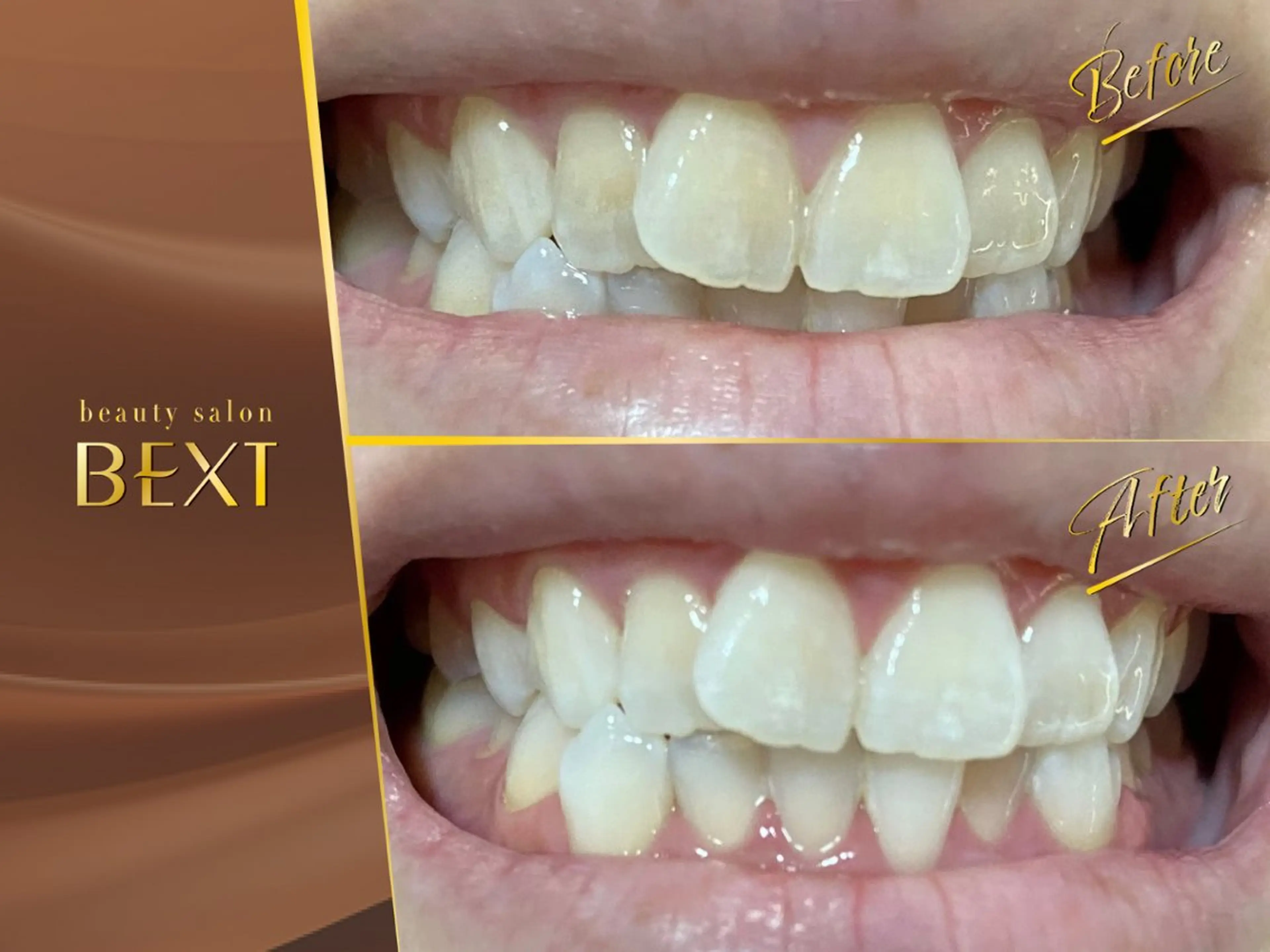 メンズ エステ リラク ビューティーサロンベクスト beautysalonBEXT所属・ビューティーサロン ベクスト名古屋のマツエク・マツパデザイン