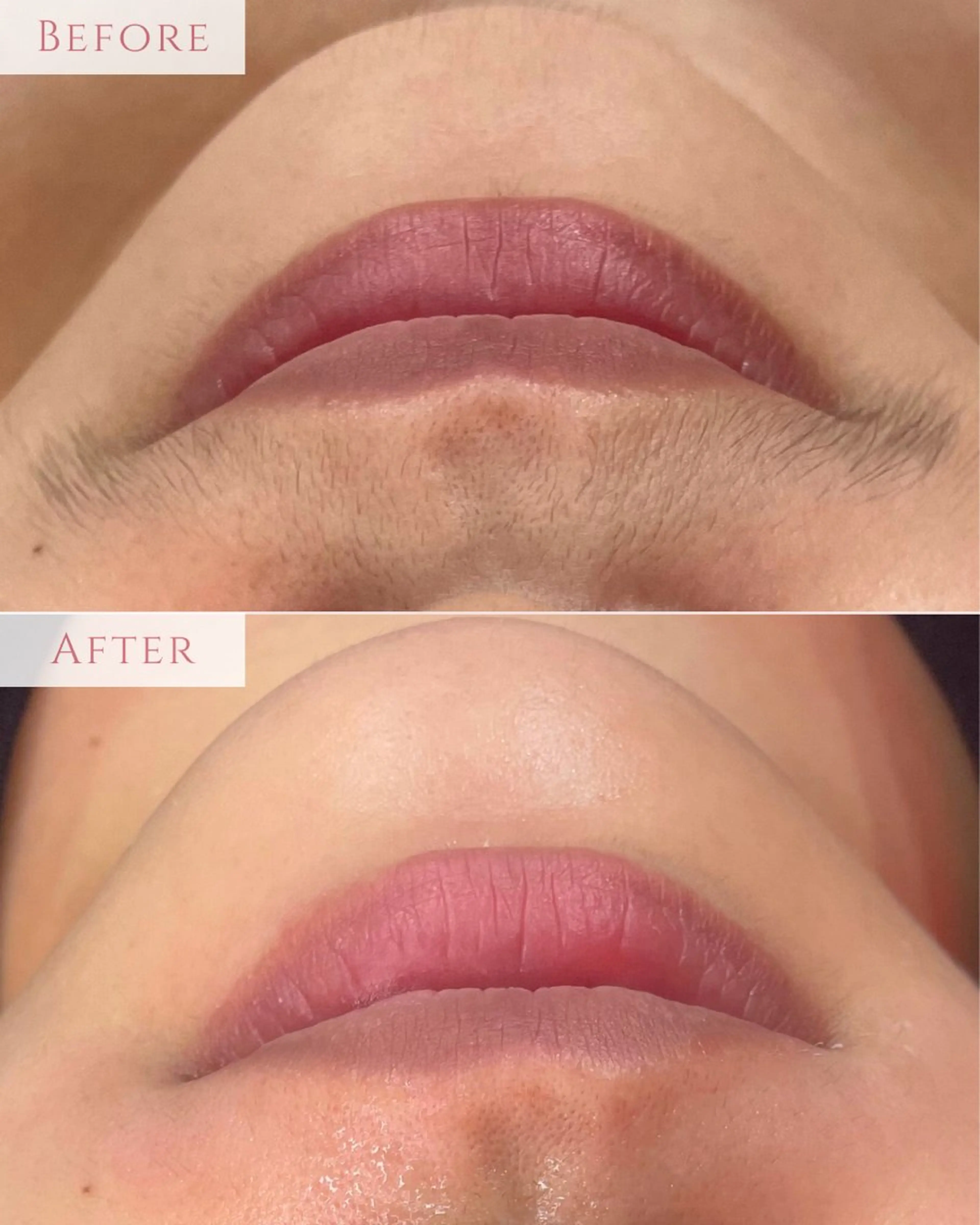 脱毛 肌質改善専門サロン Bellmi/心斎橋のエステ・リラクイメージ