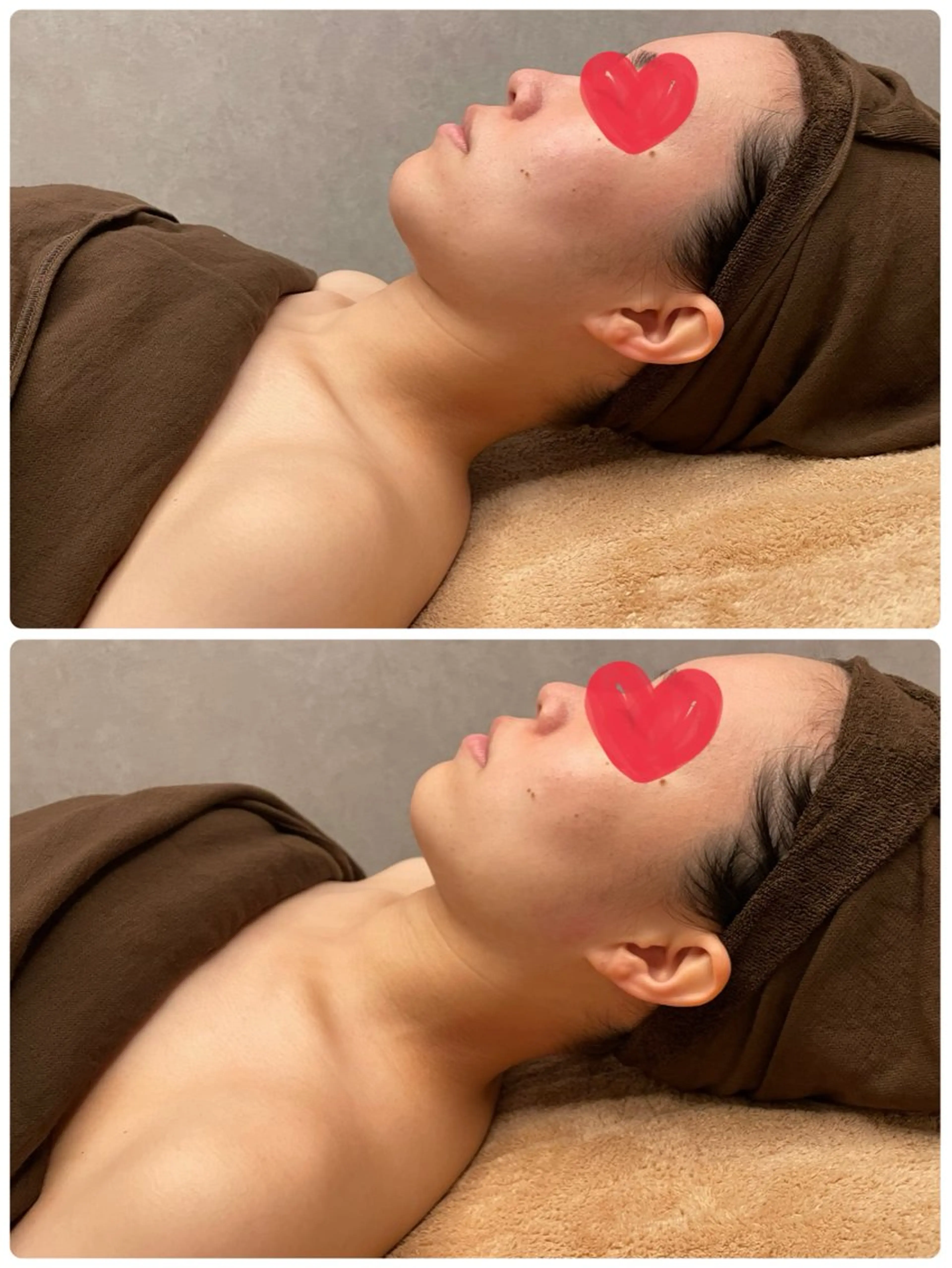 大切な日のために！ブライダル体験☆(背中＆デコルテ＆にのうで＆お顔完全網羅✨)の写真