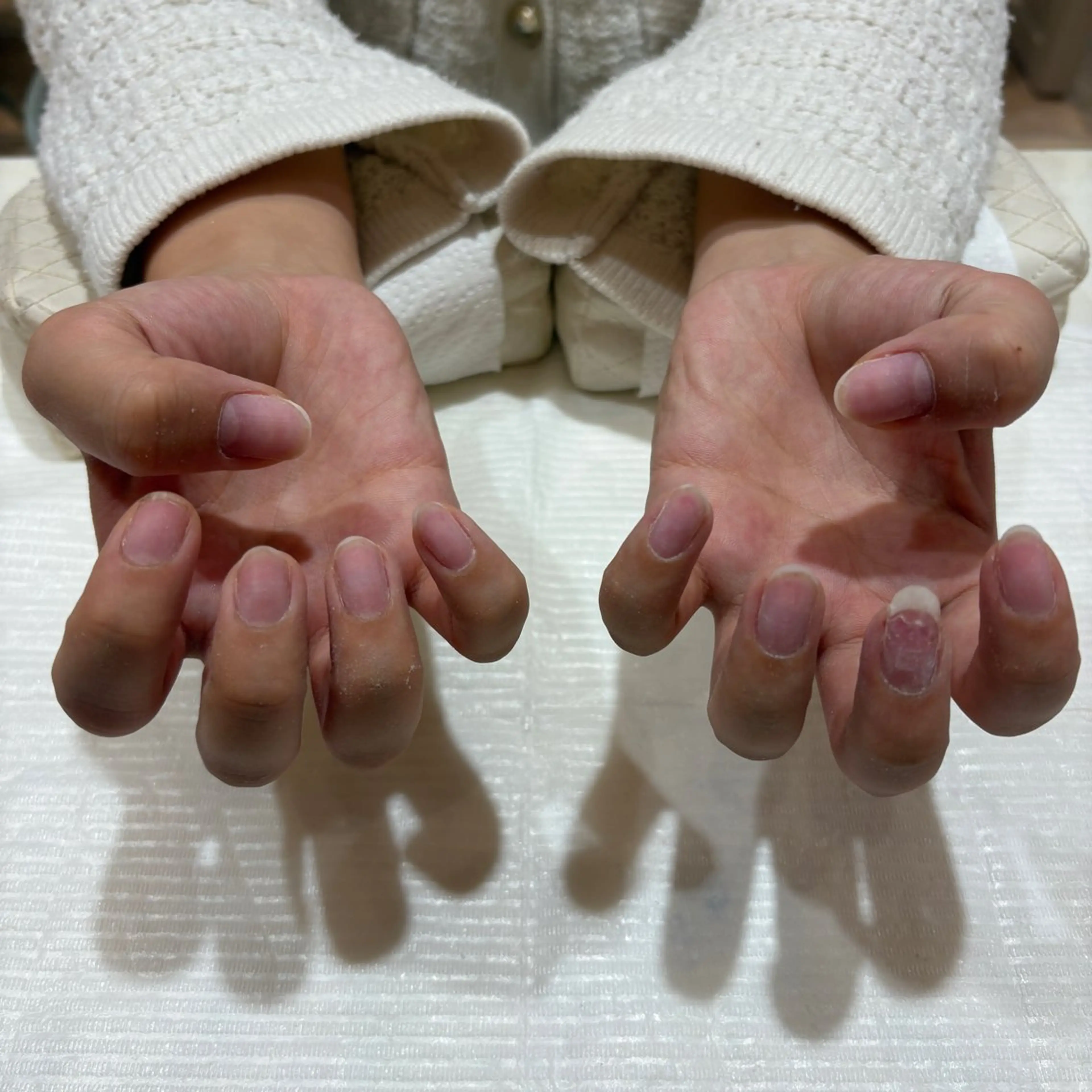 スカルプオフ✨の写真