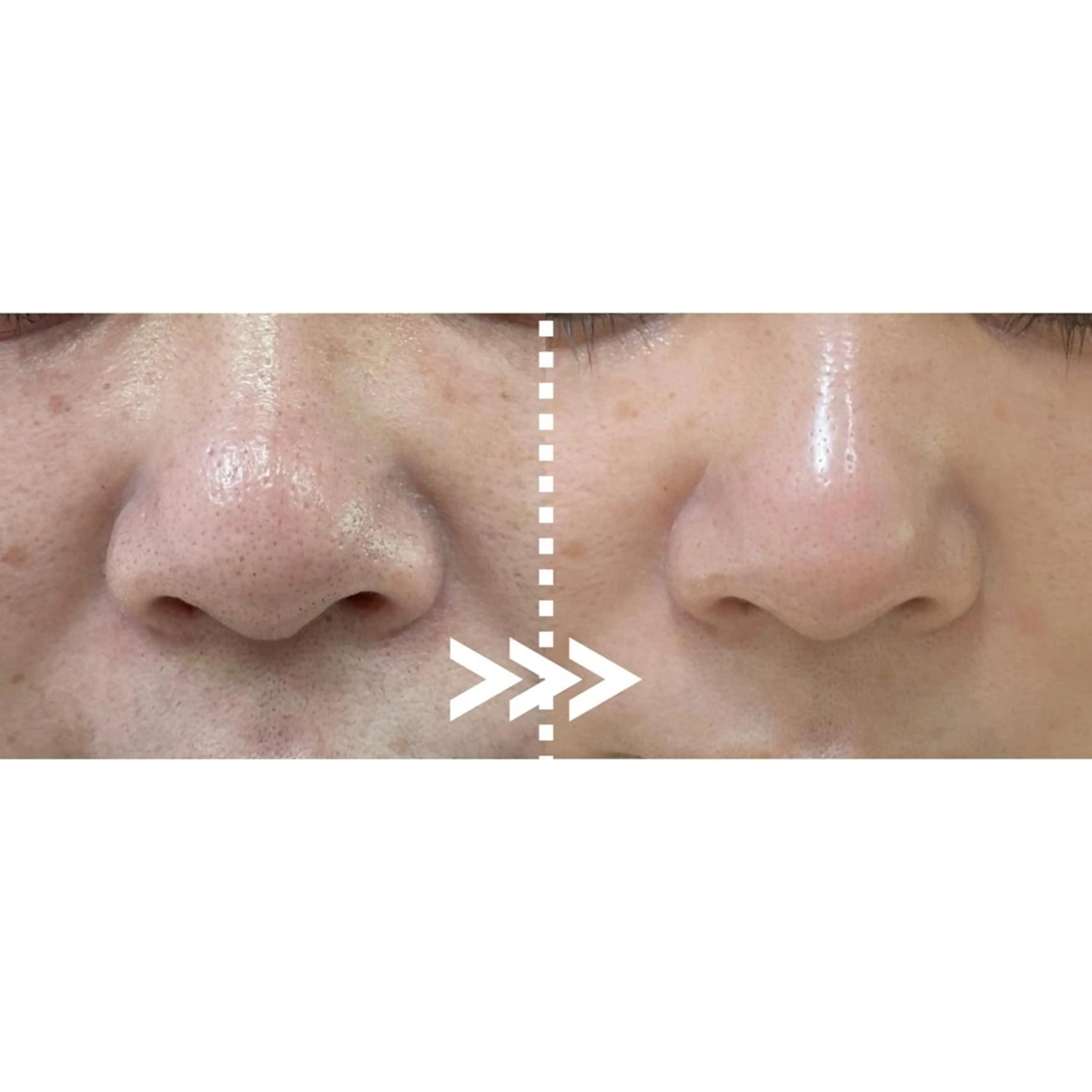 エステ 肌質改善専門 ハーブ /毛穴洗浄 リエイトのエステ・リラクイメージ