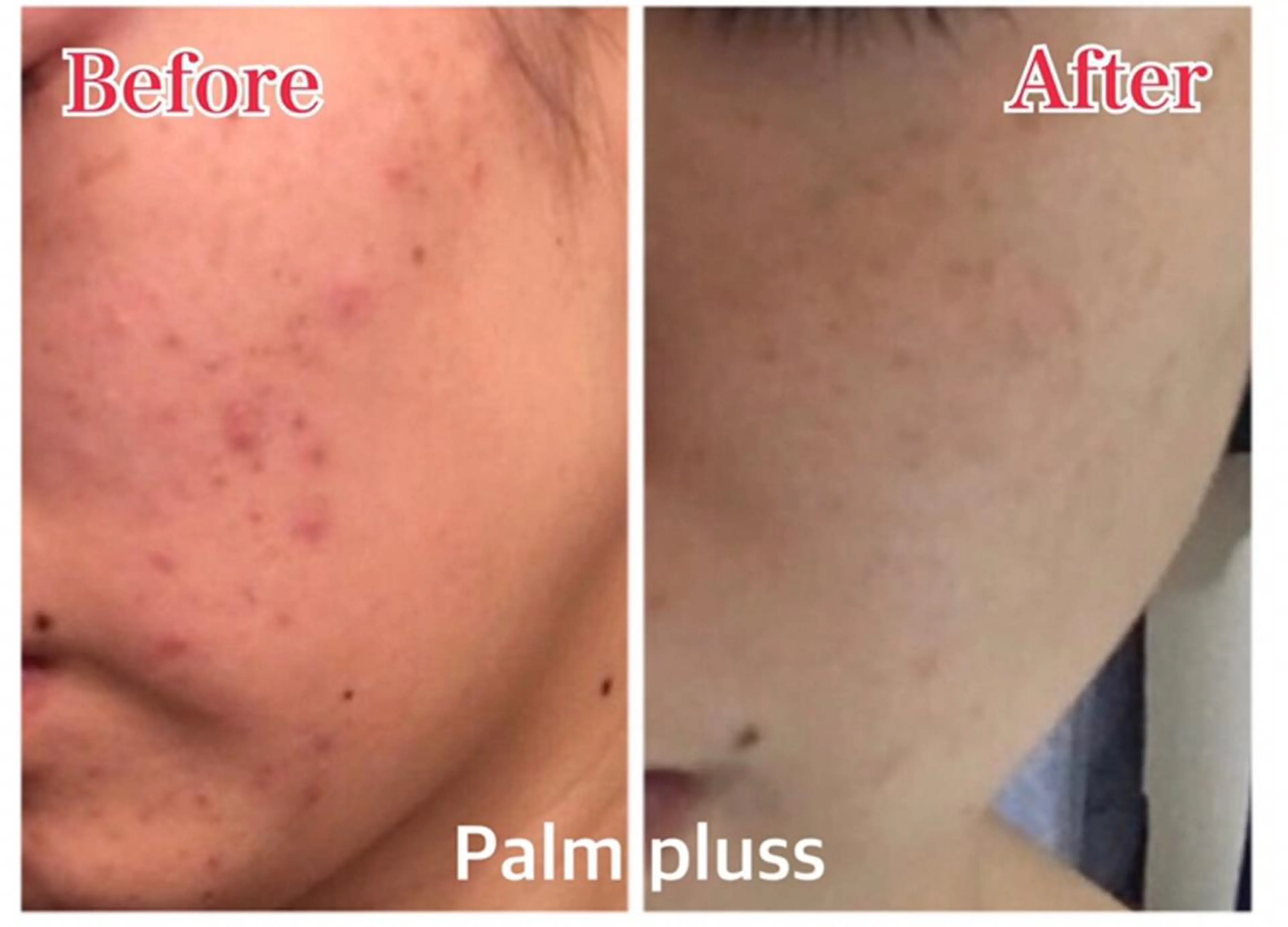 Kalnicco (カルニッコ)のエステ・リラクイメージ