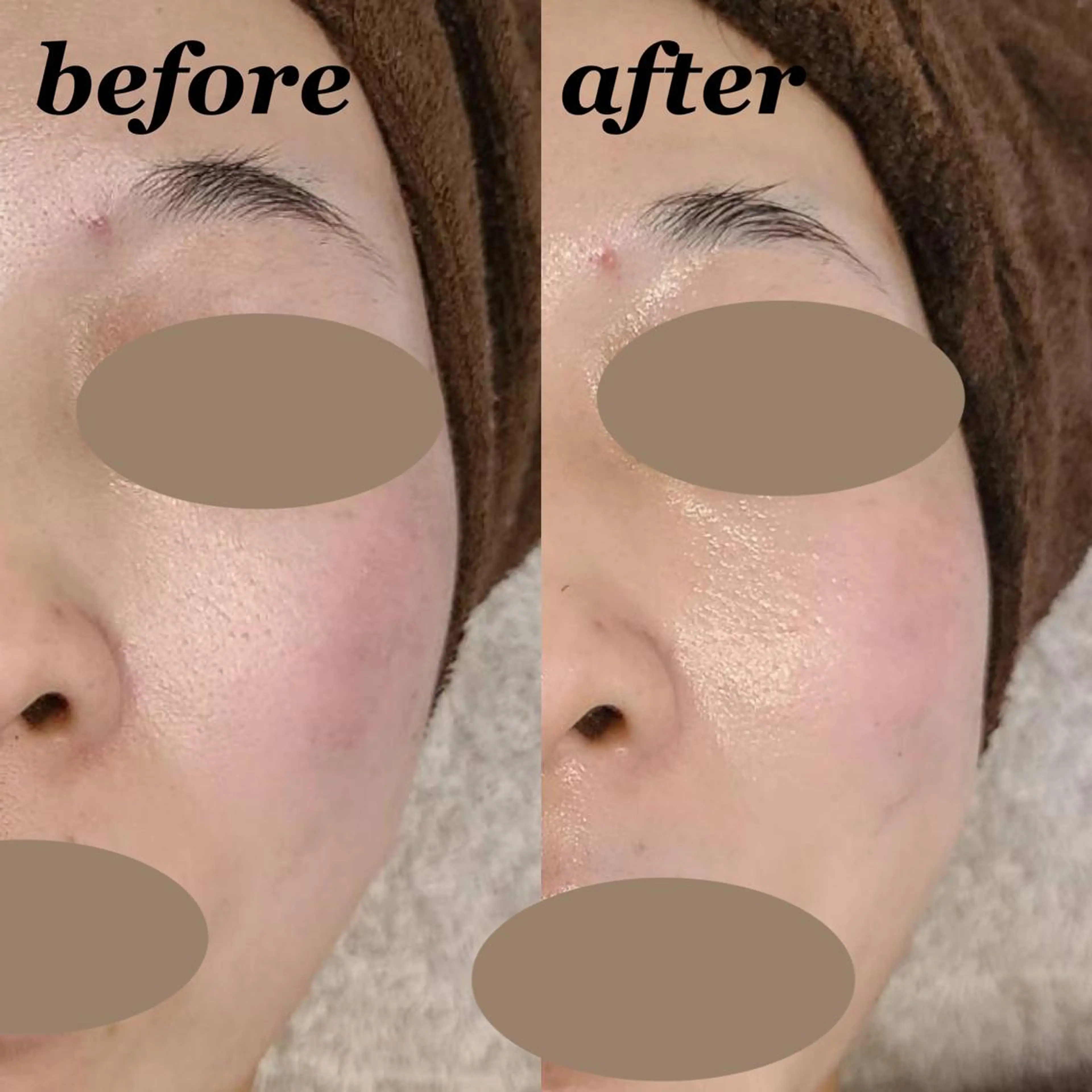 エステ total beauty DIAのネイルデザイン