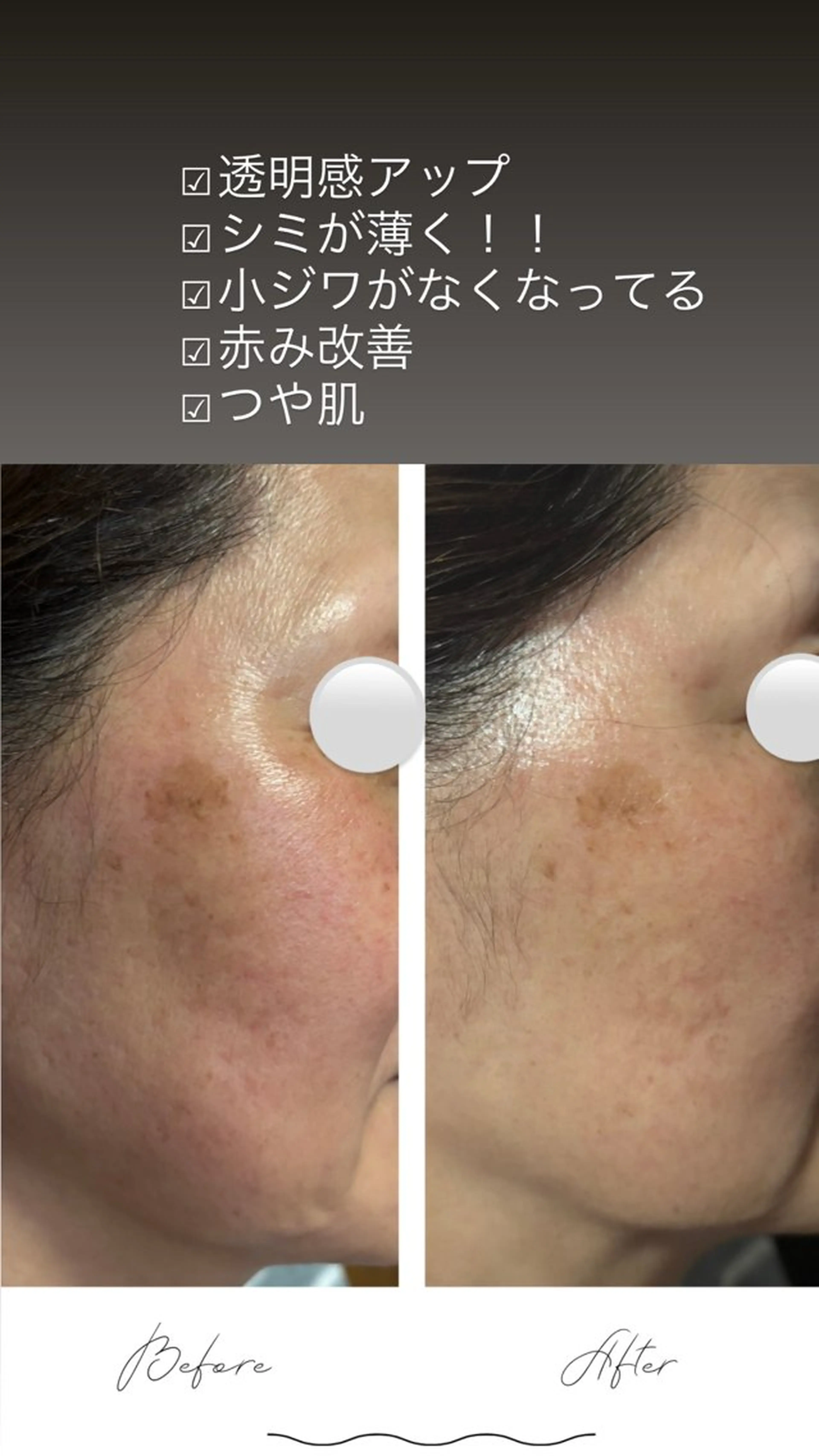 ありな 肌質改善サロンのエステ・リラクイメージ