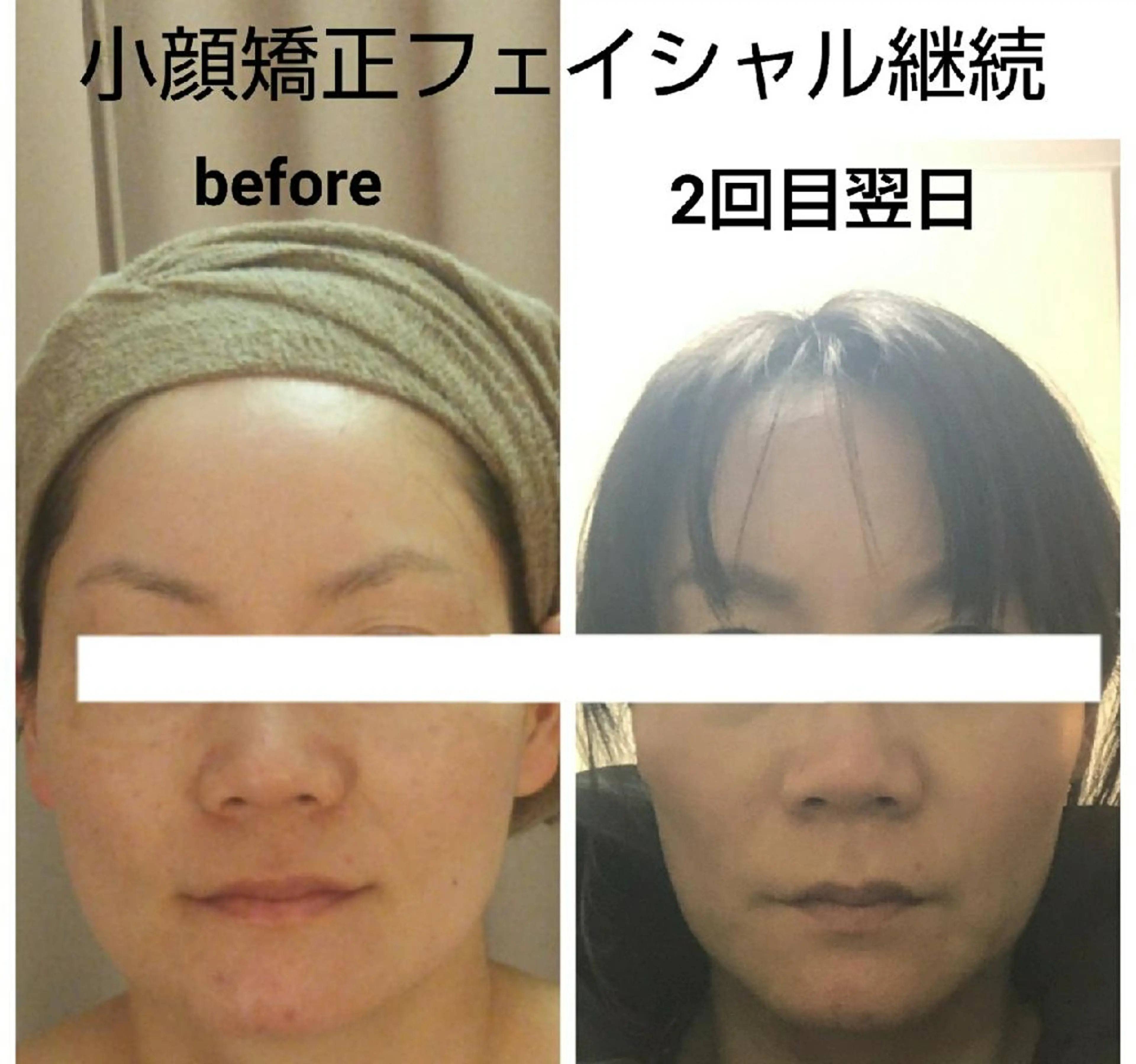 小顔と美肌 まごころエステMatoria所属・小顔 美肌専門 Matoriaのエステ・リラクイメージ