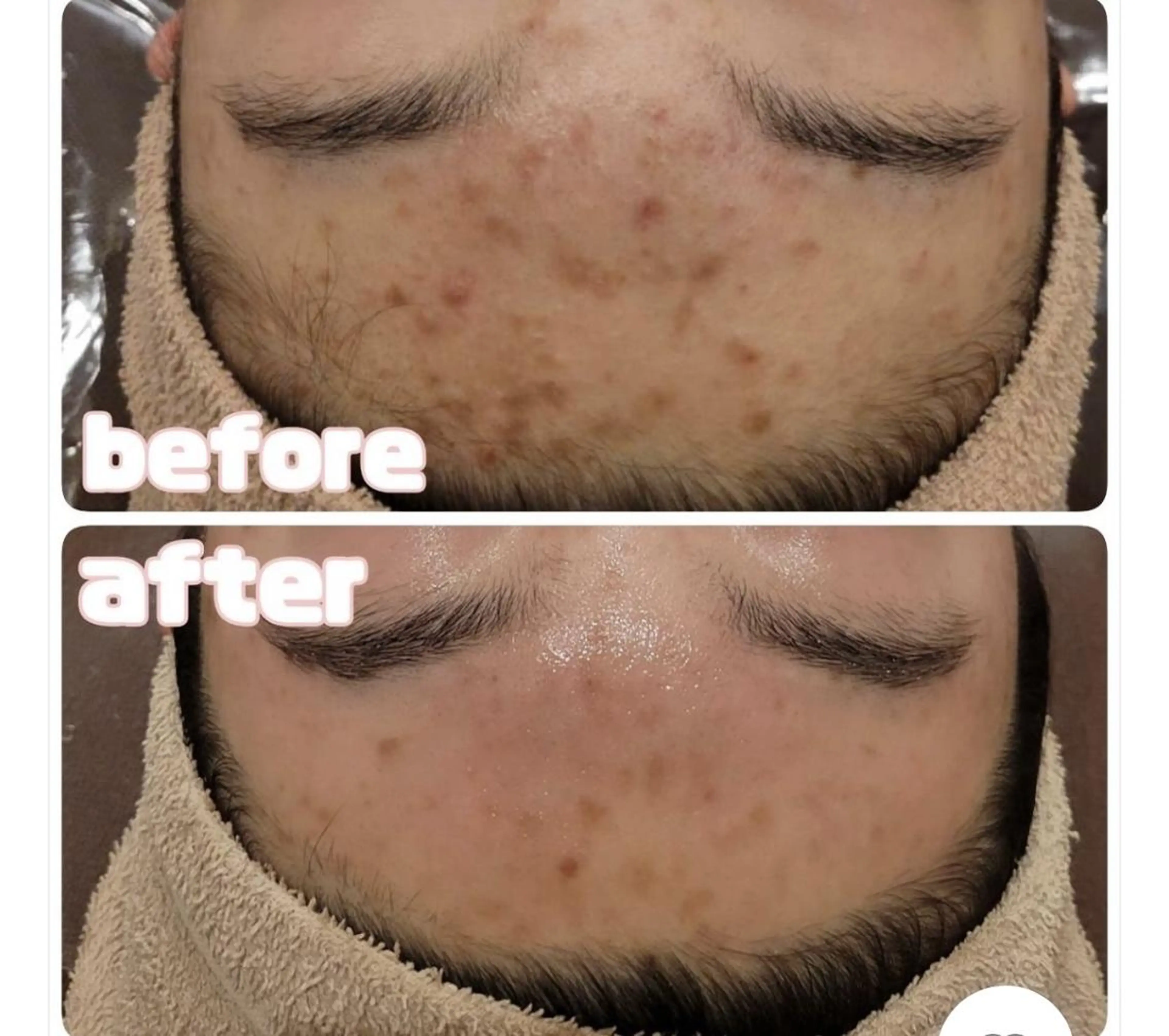 エステ 💫Linola💫 レイビス　小林のエステ・リラクイメージ