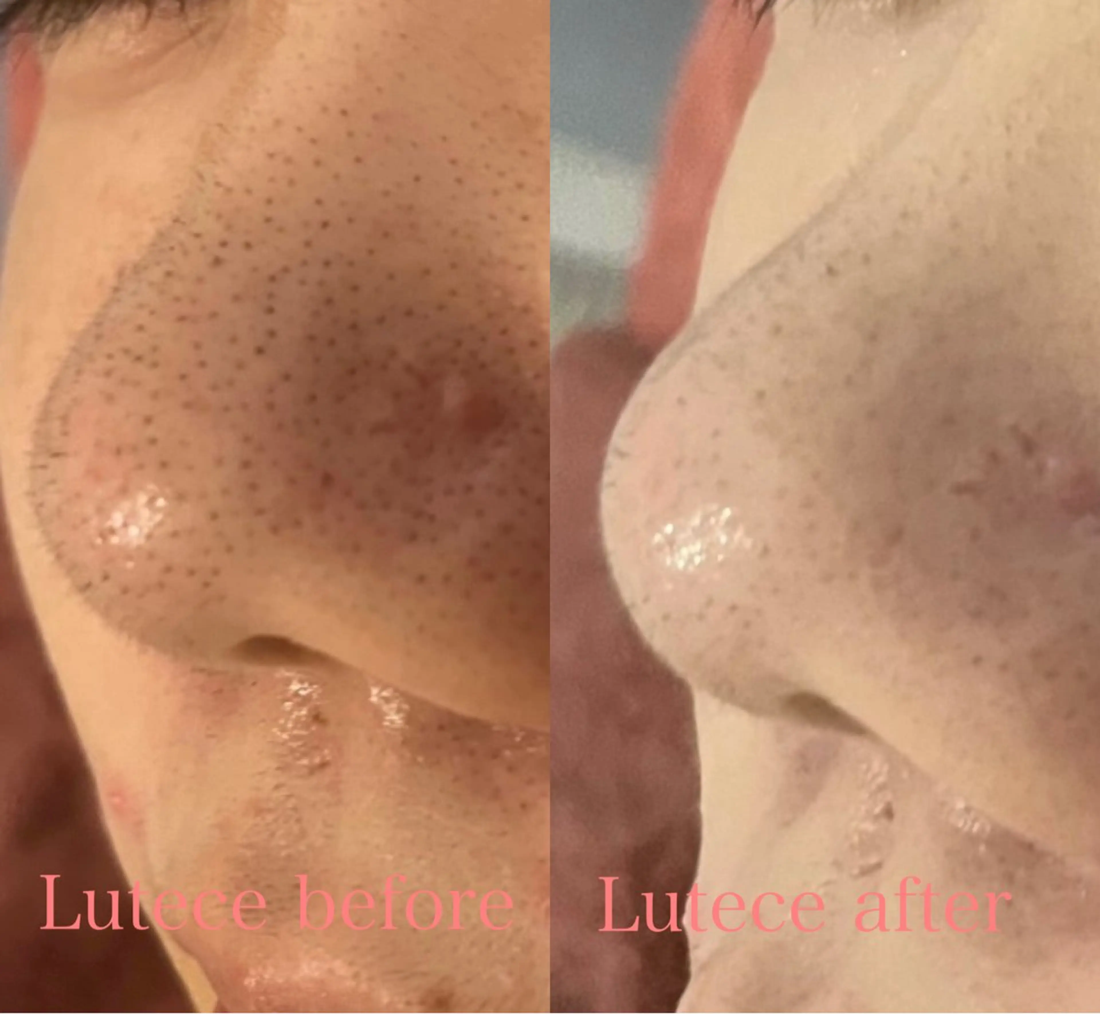 エステ 池田 麻美子のエステ・リラクイメージ