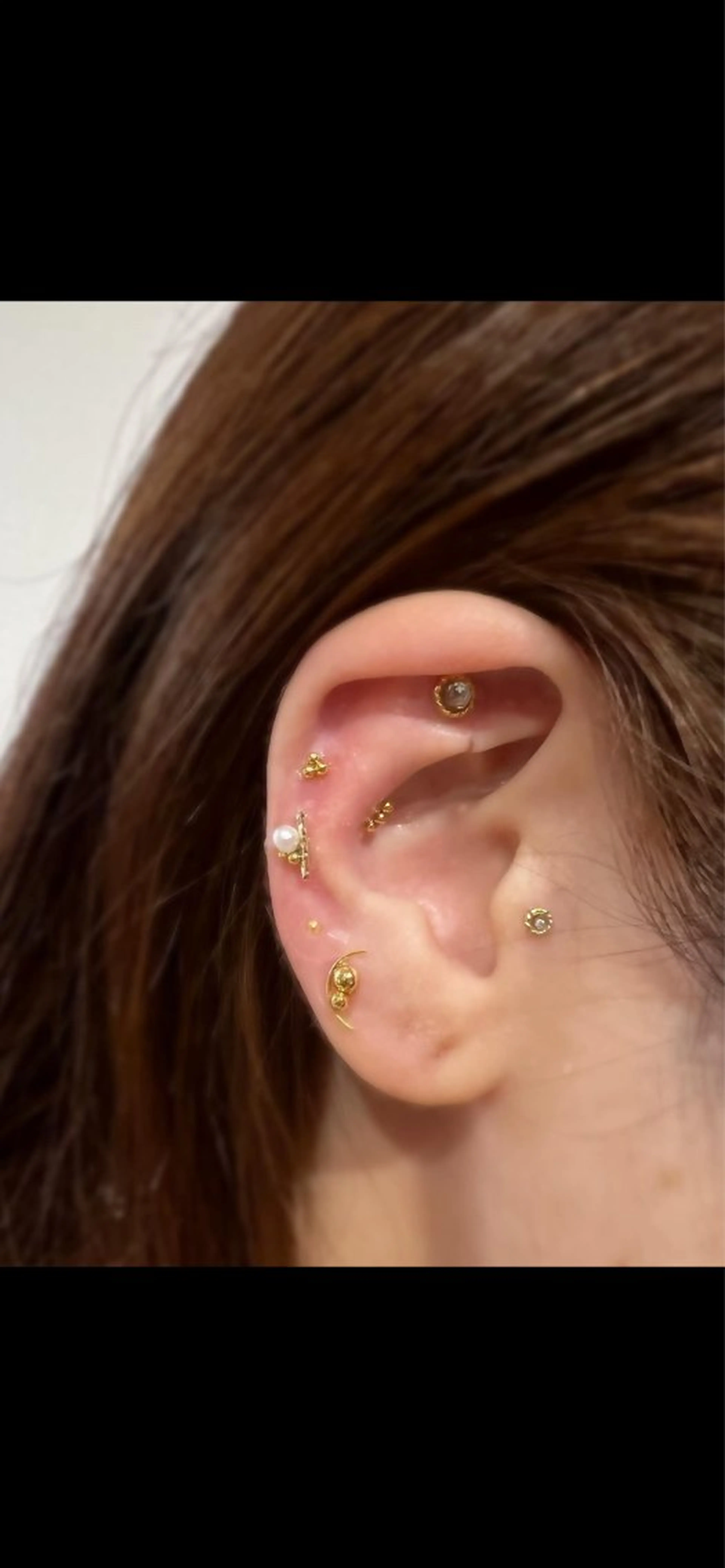 その他 肌質改善|美眉サロンCannone'所属・肌質改善|美眉サロン Cannone’のエステ・リラクイメージ