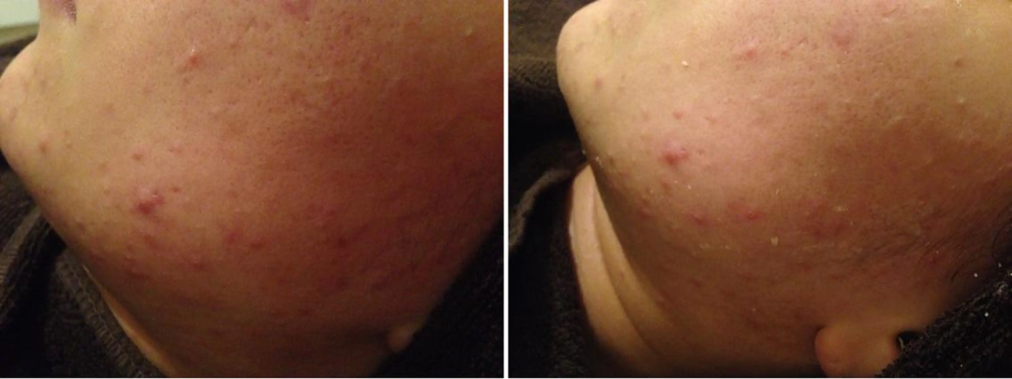 ロング カラー パーマ ヘアアレンジ メンズ キッズ ネイル マツエク・マツパ アニメ,Vオタク× 即効痩せエステサロンのエステ・リラクイメージ