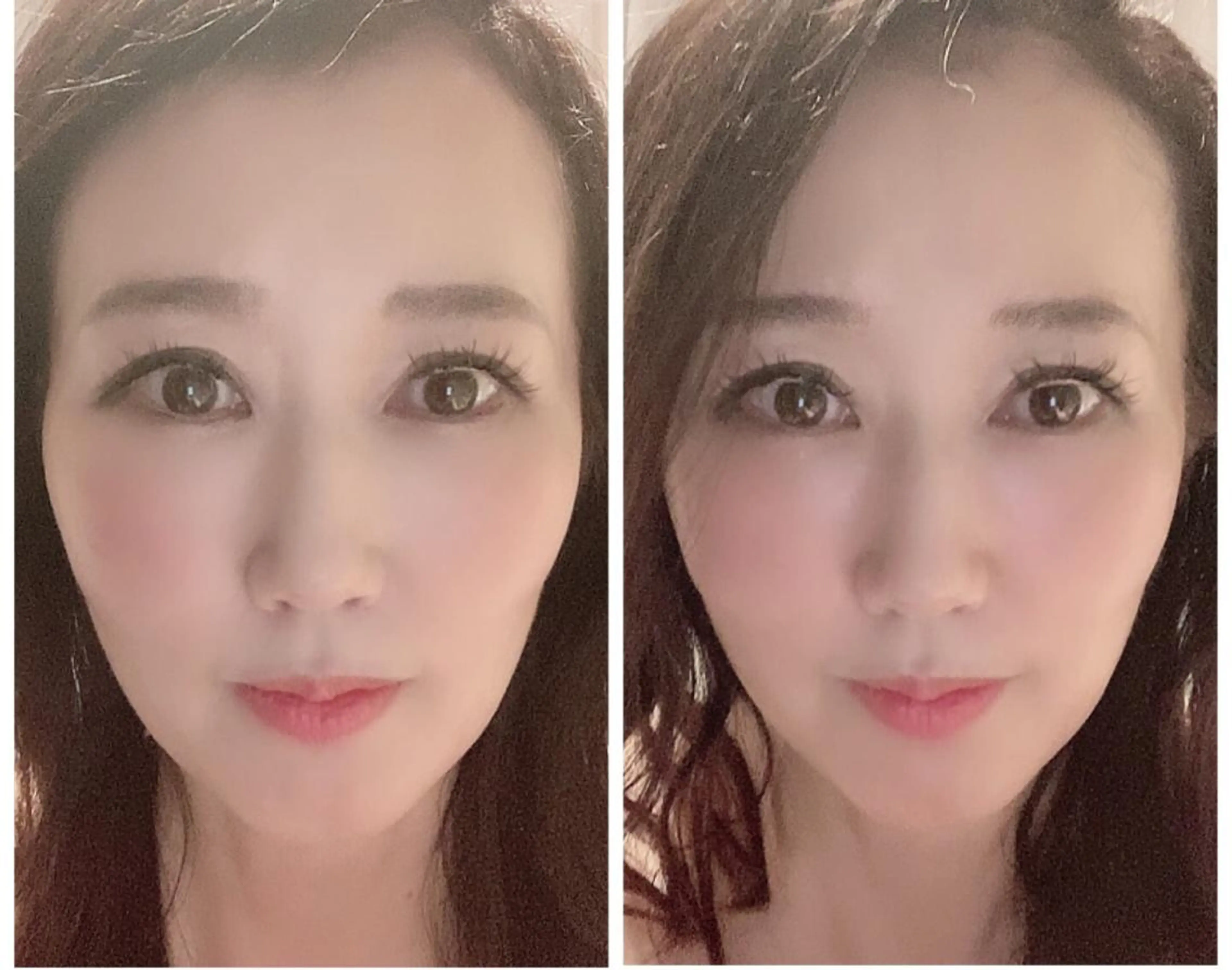 調律エステ /美KISSのその他イメージ