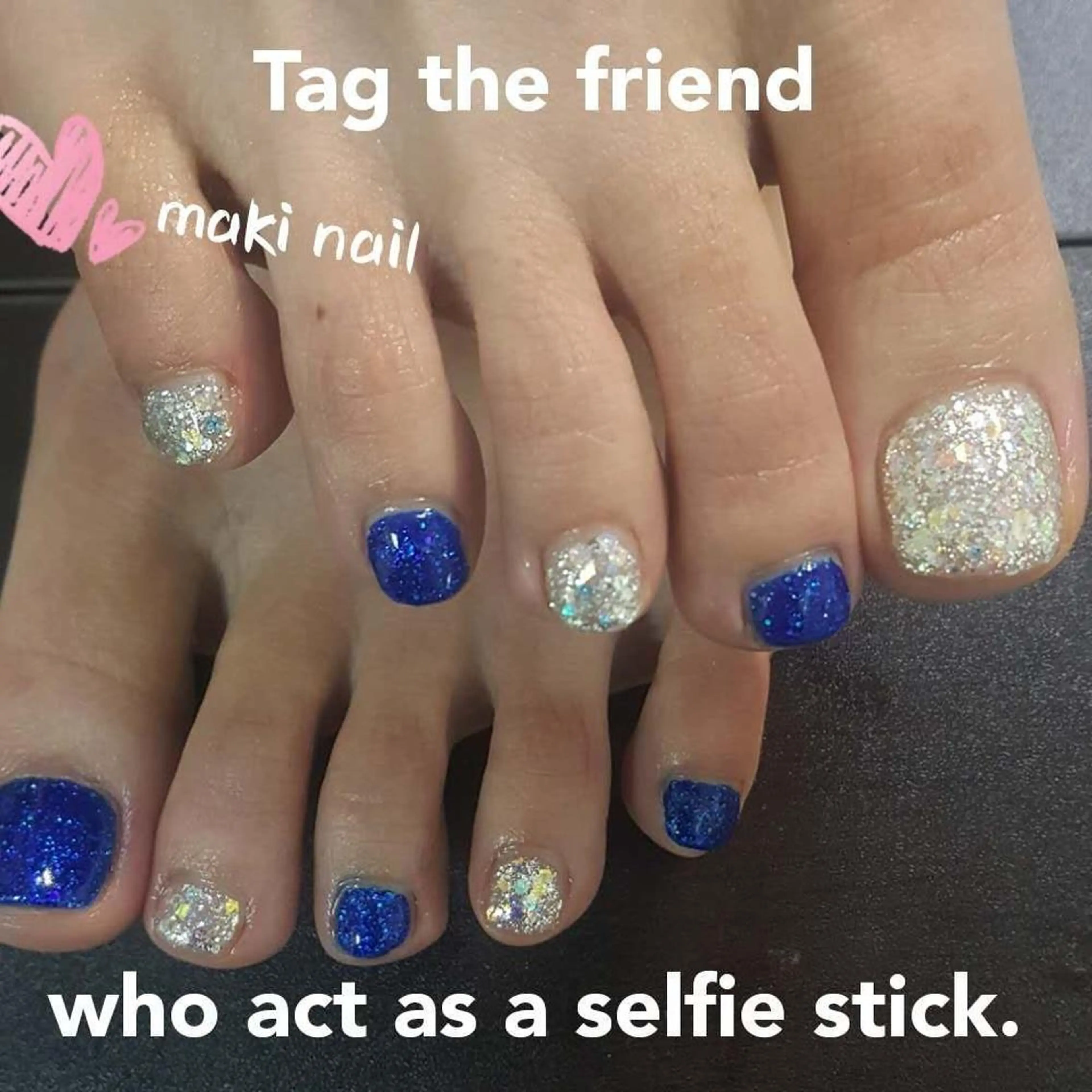 【オフあり】　フットネイル　2色のワンカラーの写真