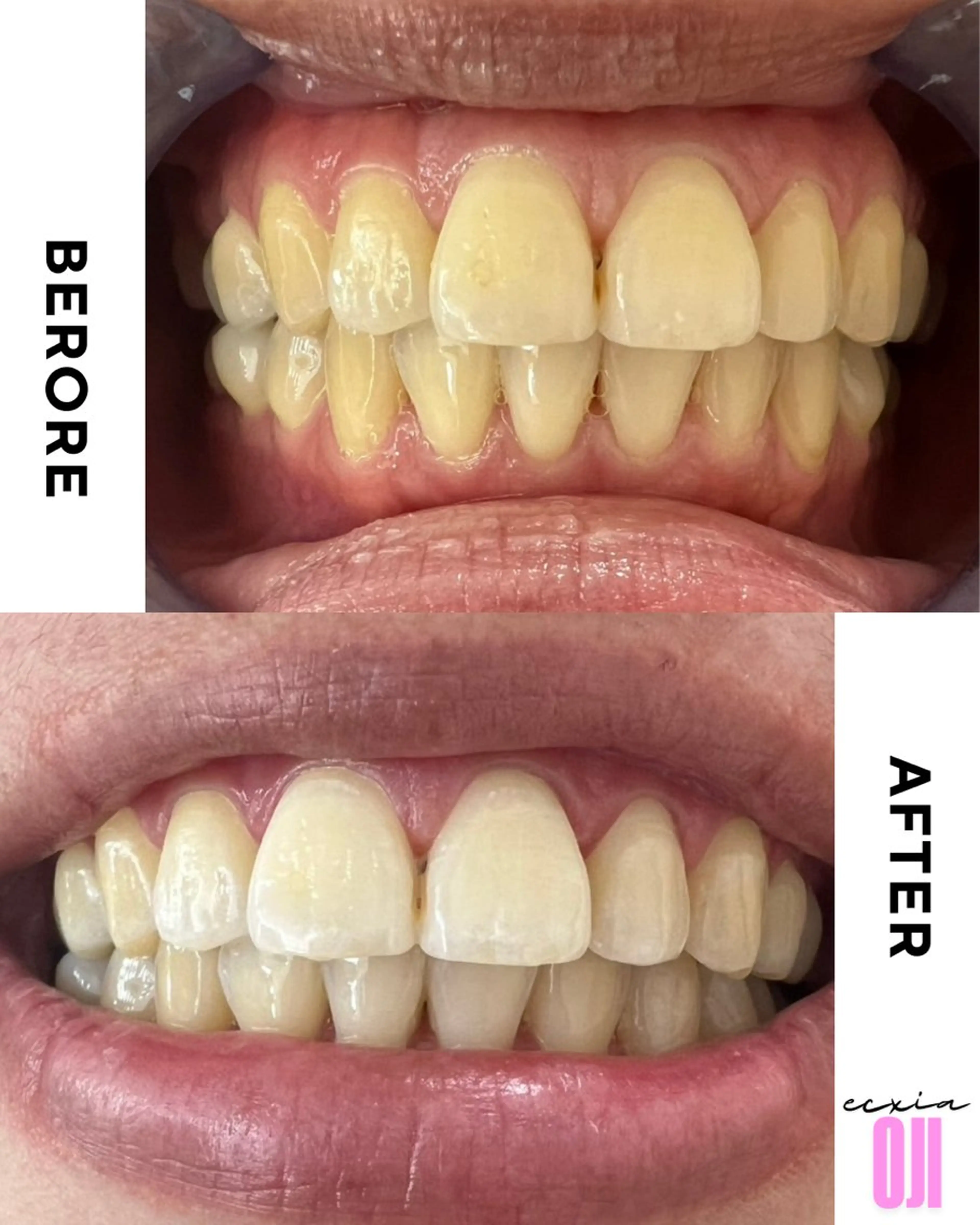 その他 セルフホワイトニングサロン  エクシアホワイト 王寺店所属・エクシア王寺 NISHIKAWAのその他イメージ