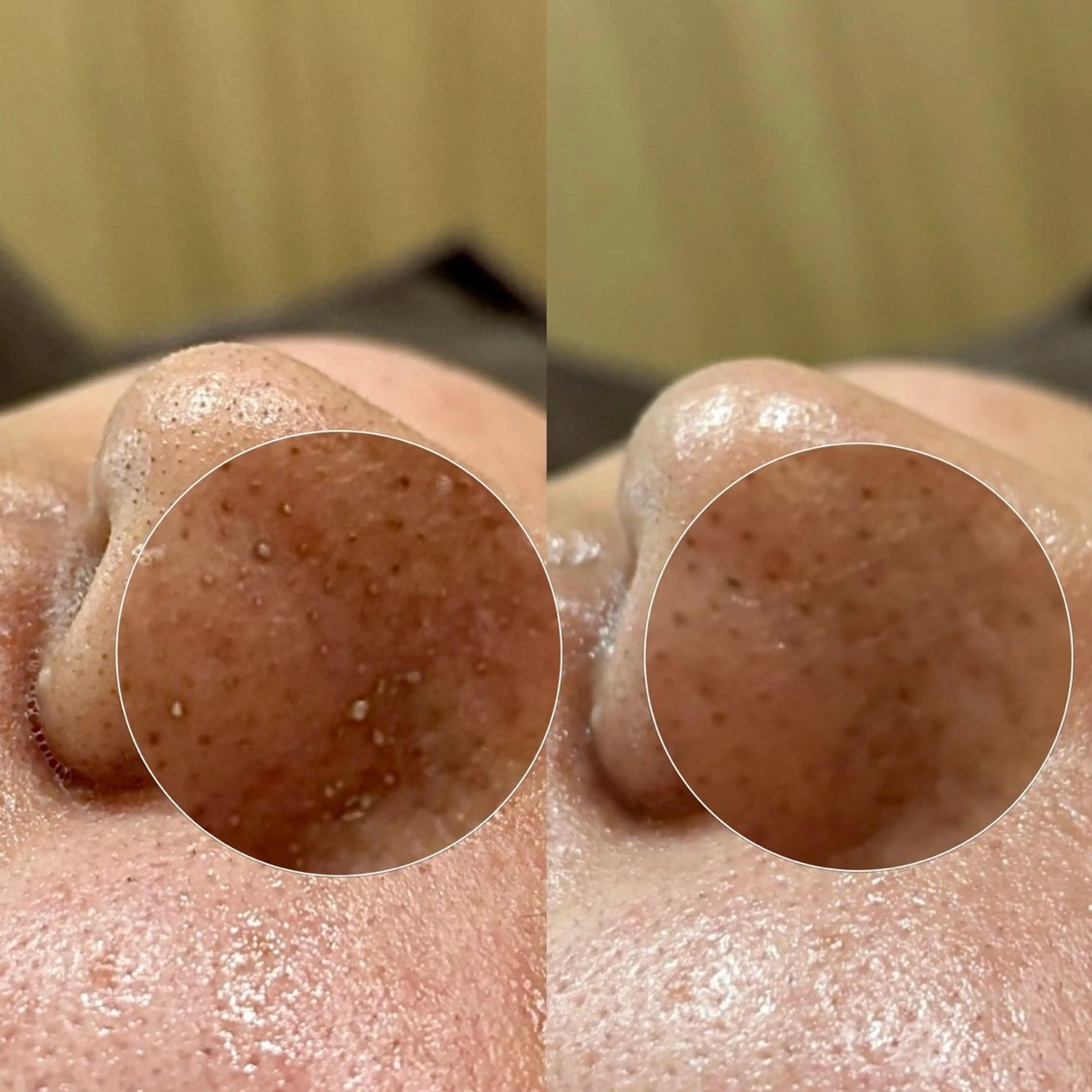 エステ Suu.千種/今池 毛穴洗浄/韓国肌管理の眉毛・アイブロウイメージ