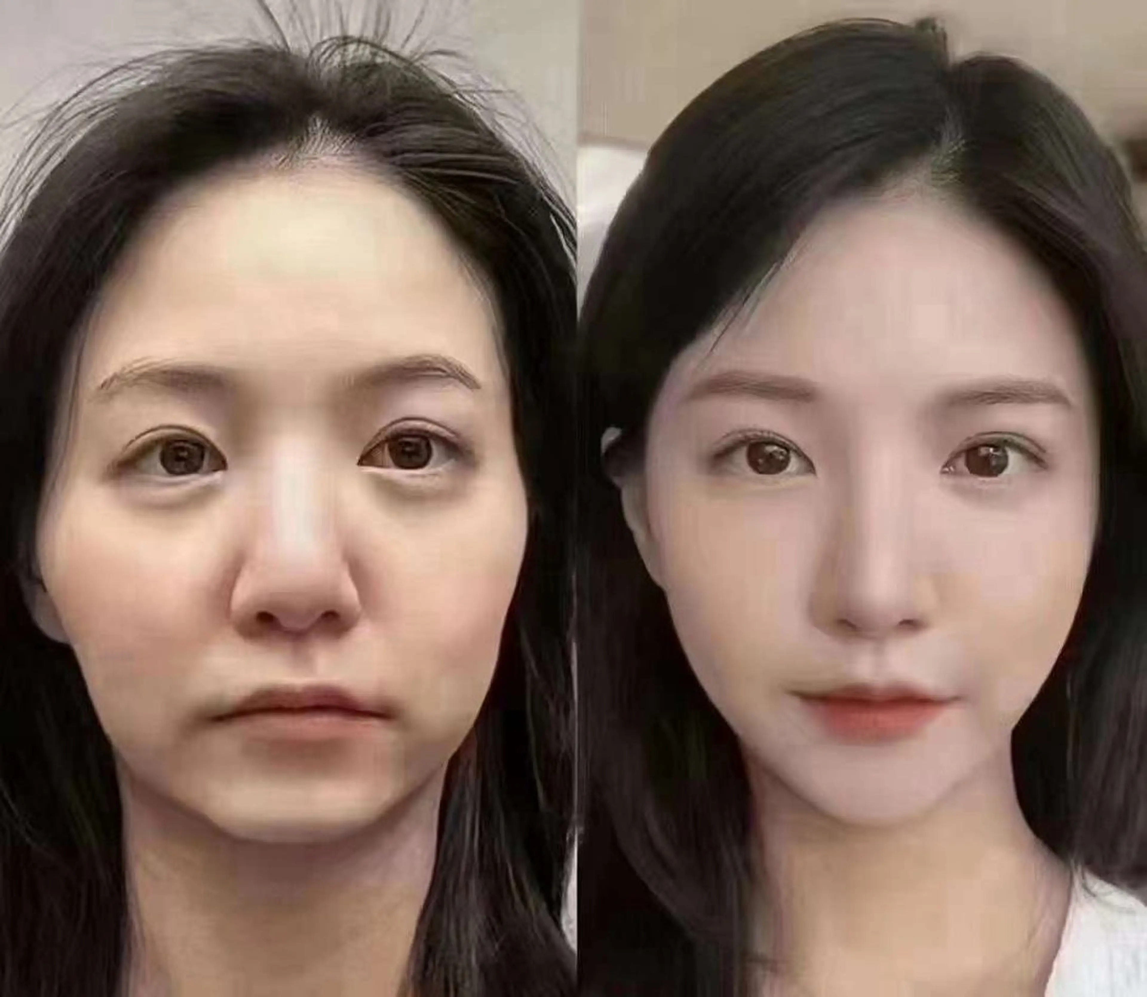 ネイル エステ aliaハーブ水光店 エステティシャン募集のエステ・リラクイメージ