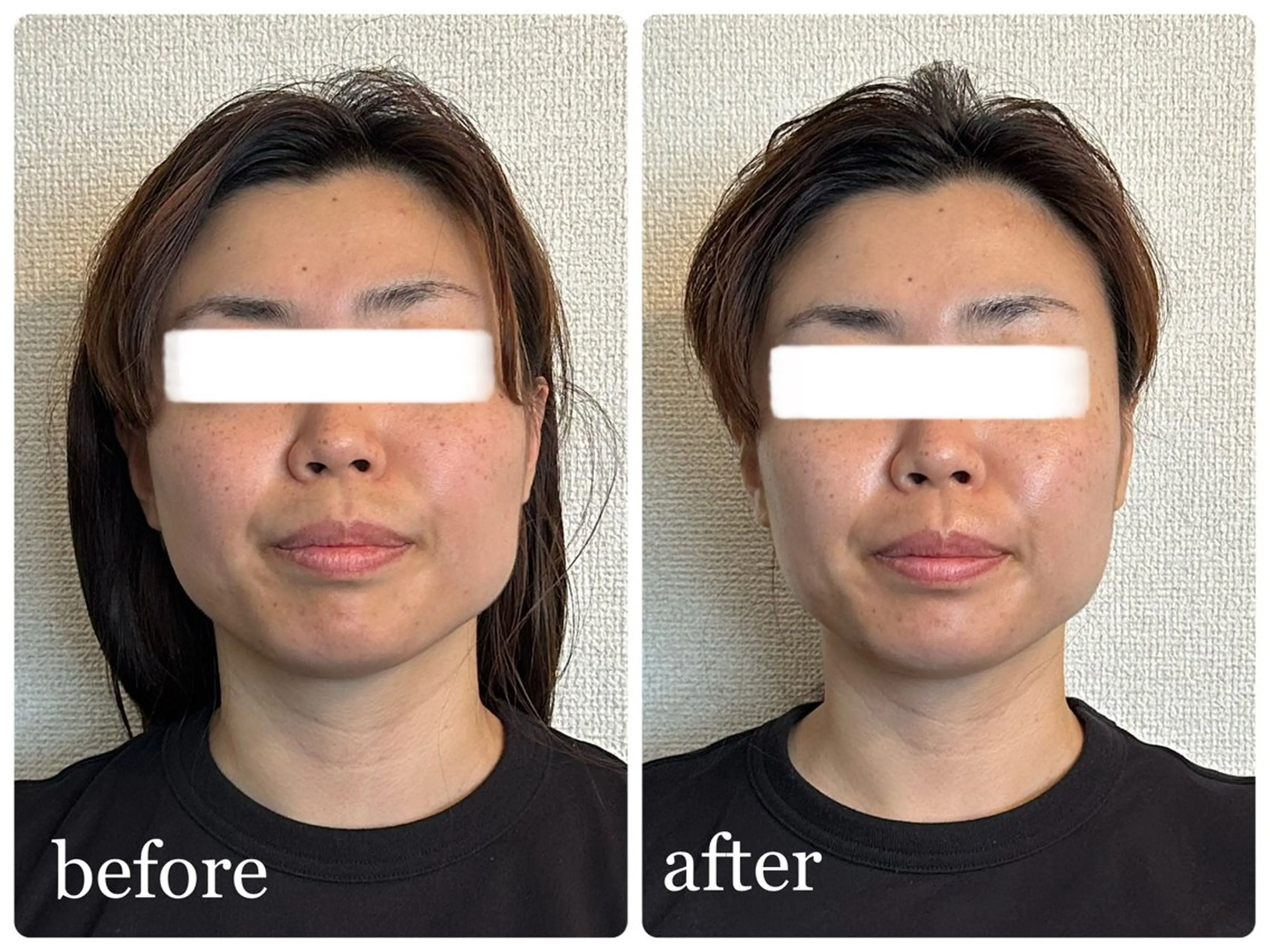 ハイフ・小顔・骨盤 シャングリラのエステ・リラクイメージ