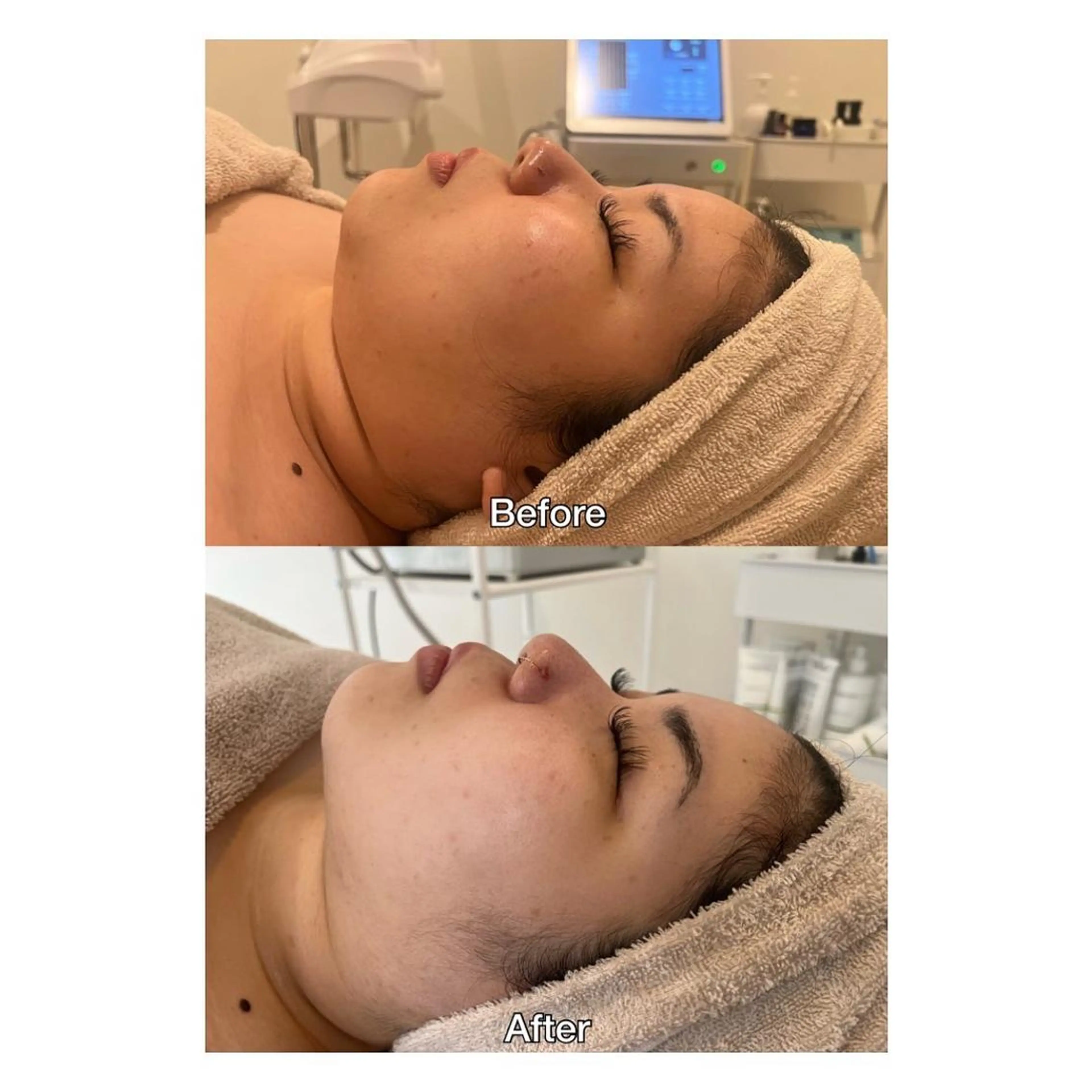 ROOM.S ｜脱毛｜美肌｜ボディのエステ・リラクイメージ