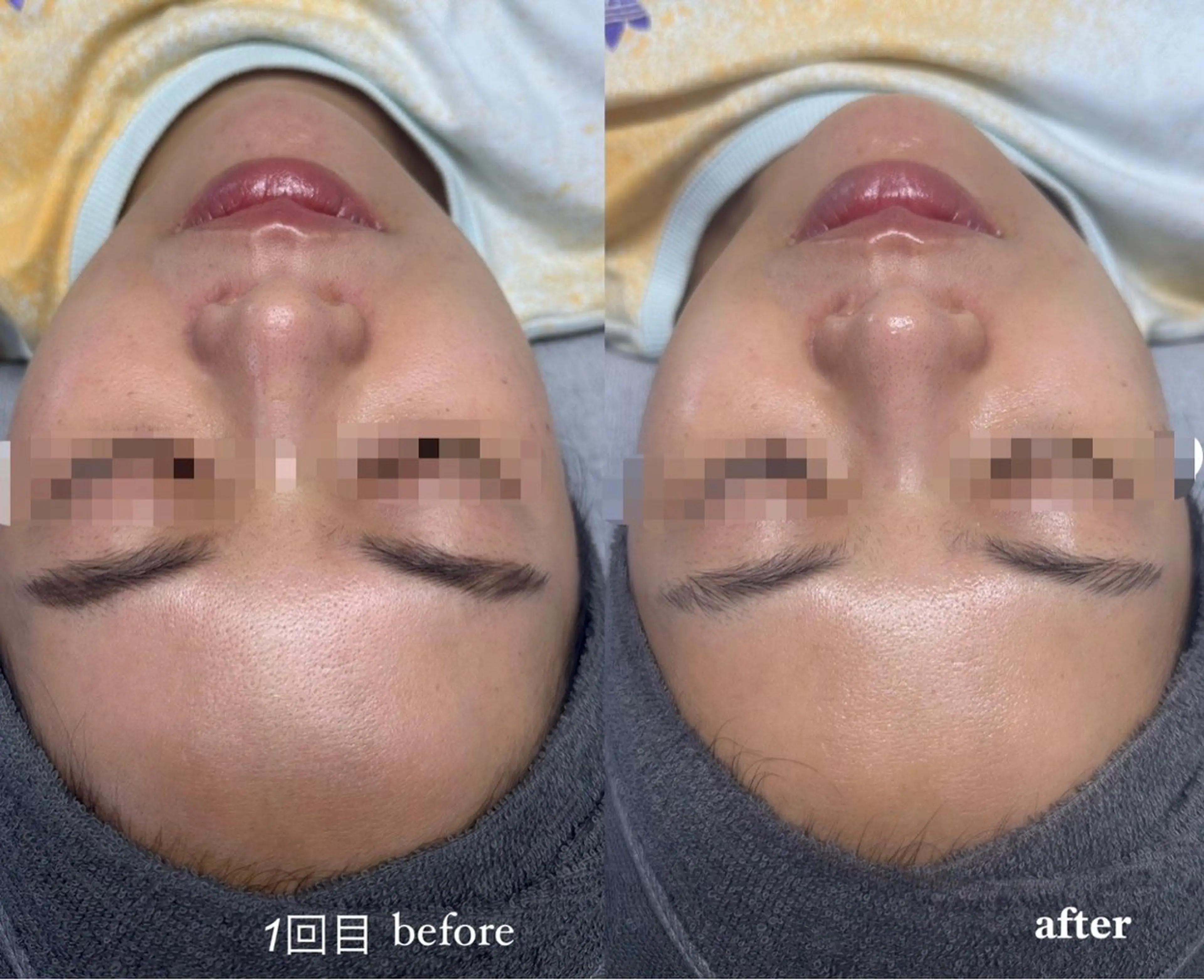 Lily 竹前のネイルデザイン