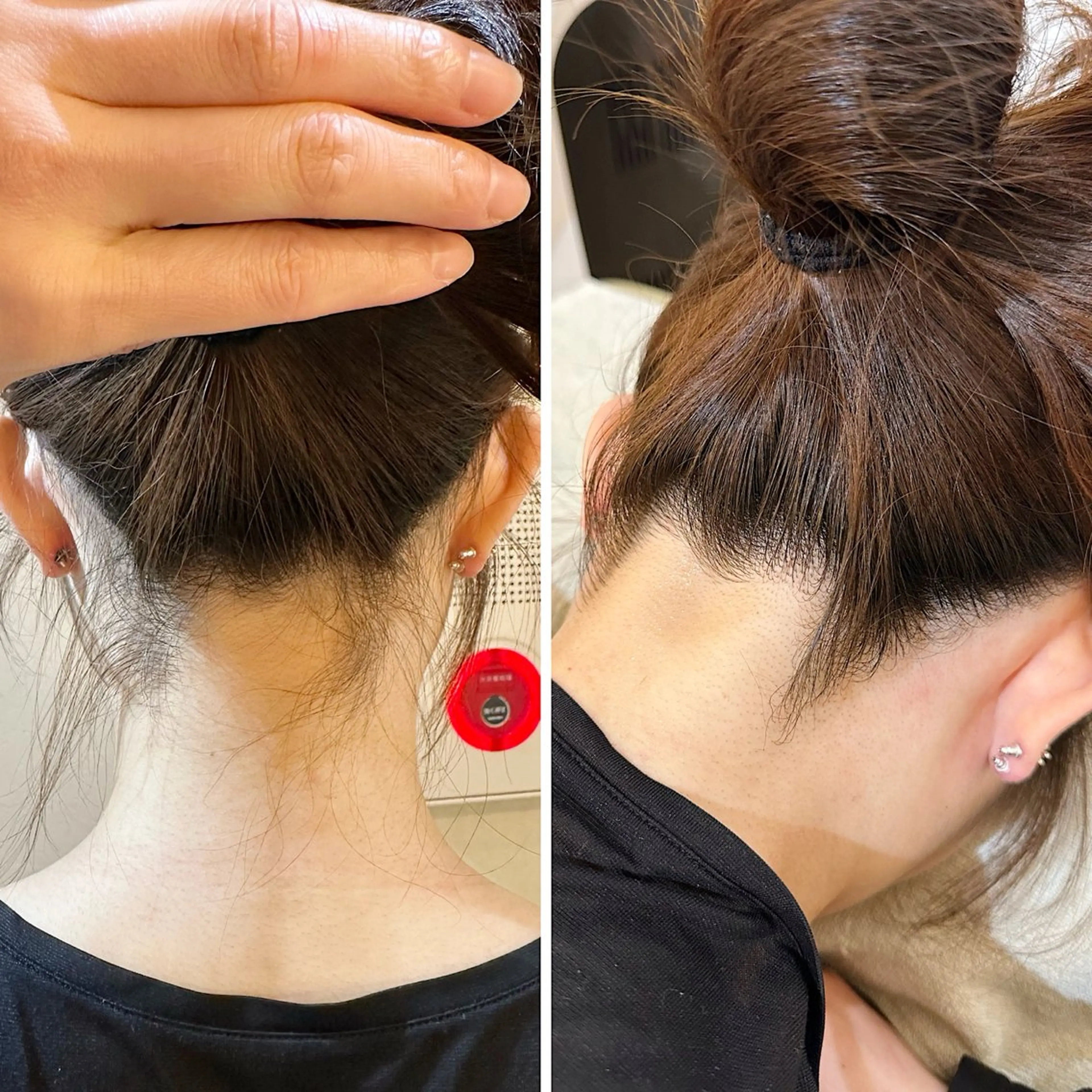 うなじ脱毛/美肌脱毛 LABELのエステ・リラクイメージ