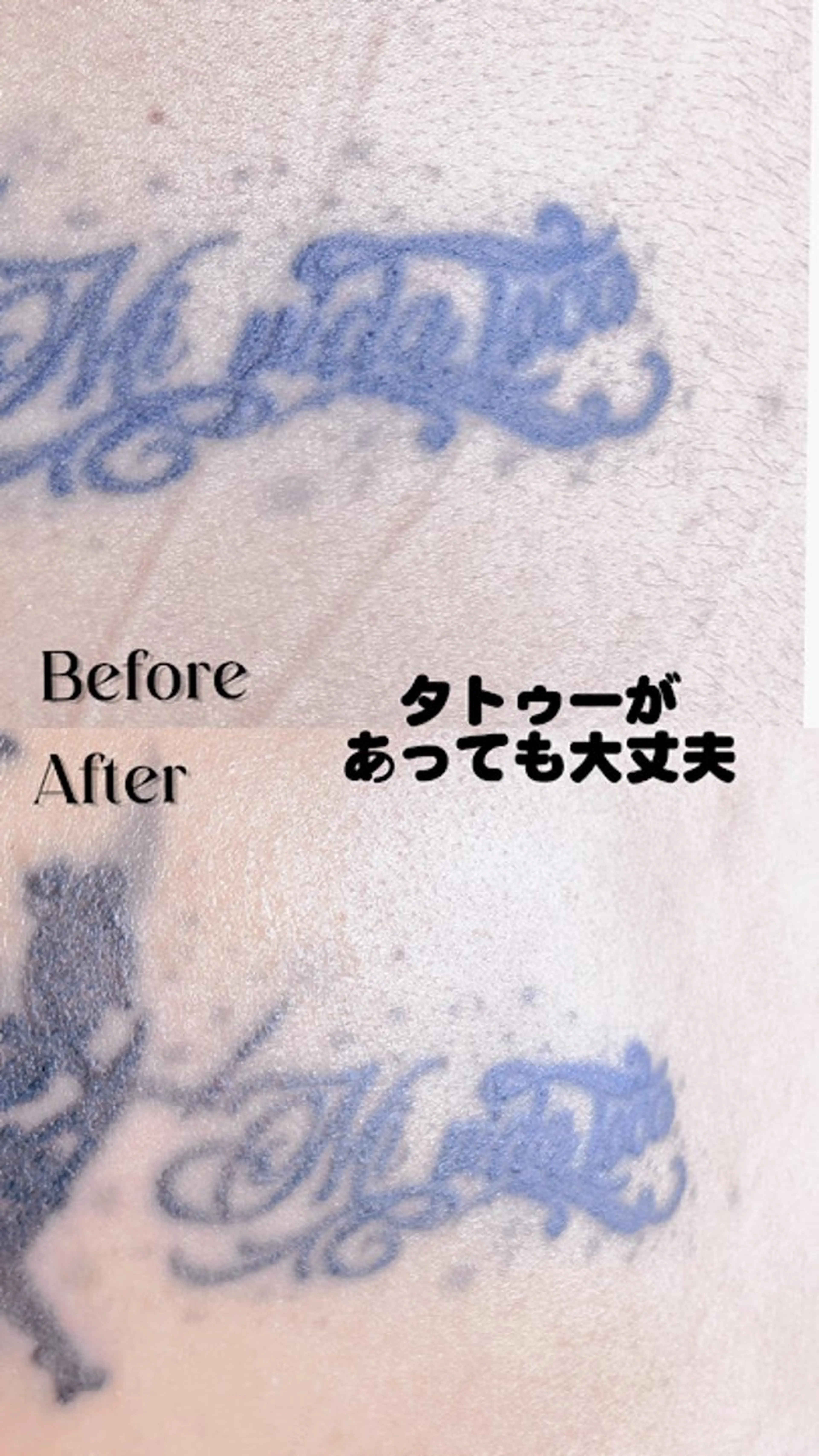 Hitomi シュガーリング豊橋のその他イメージ