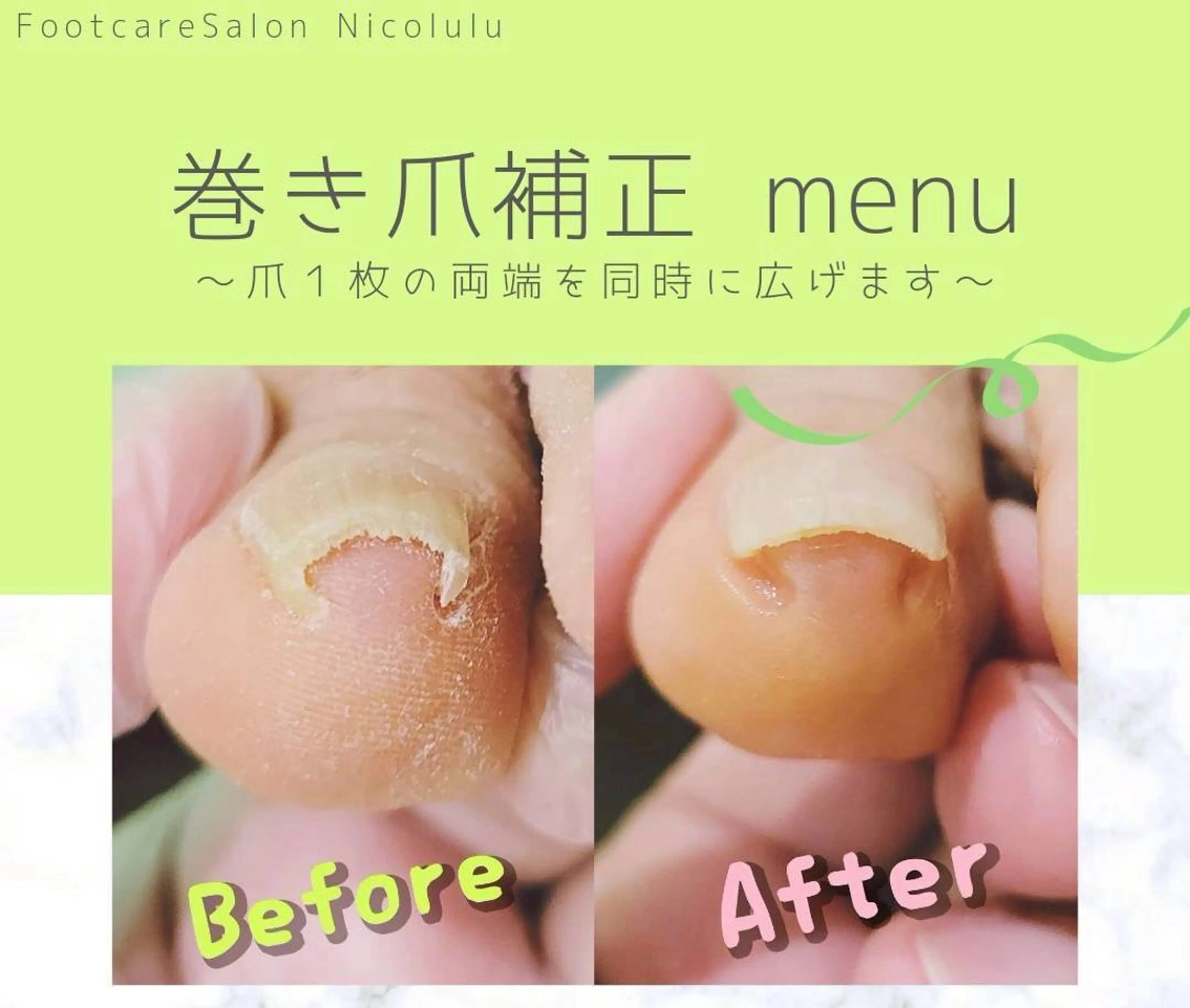 メンズ リラク 足トラブル専門 ニコルル金沢のエステ・リラクイメージ