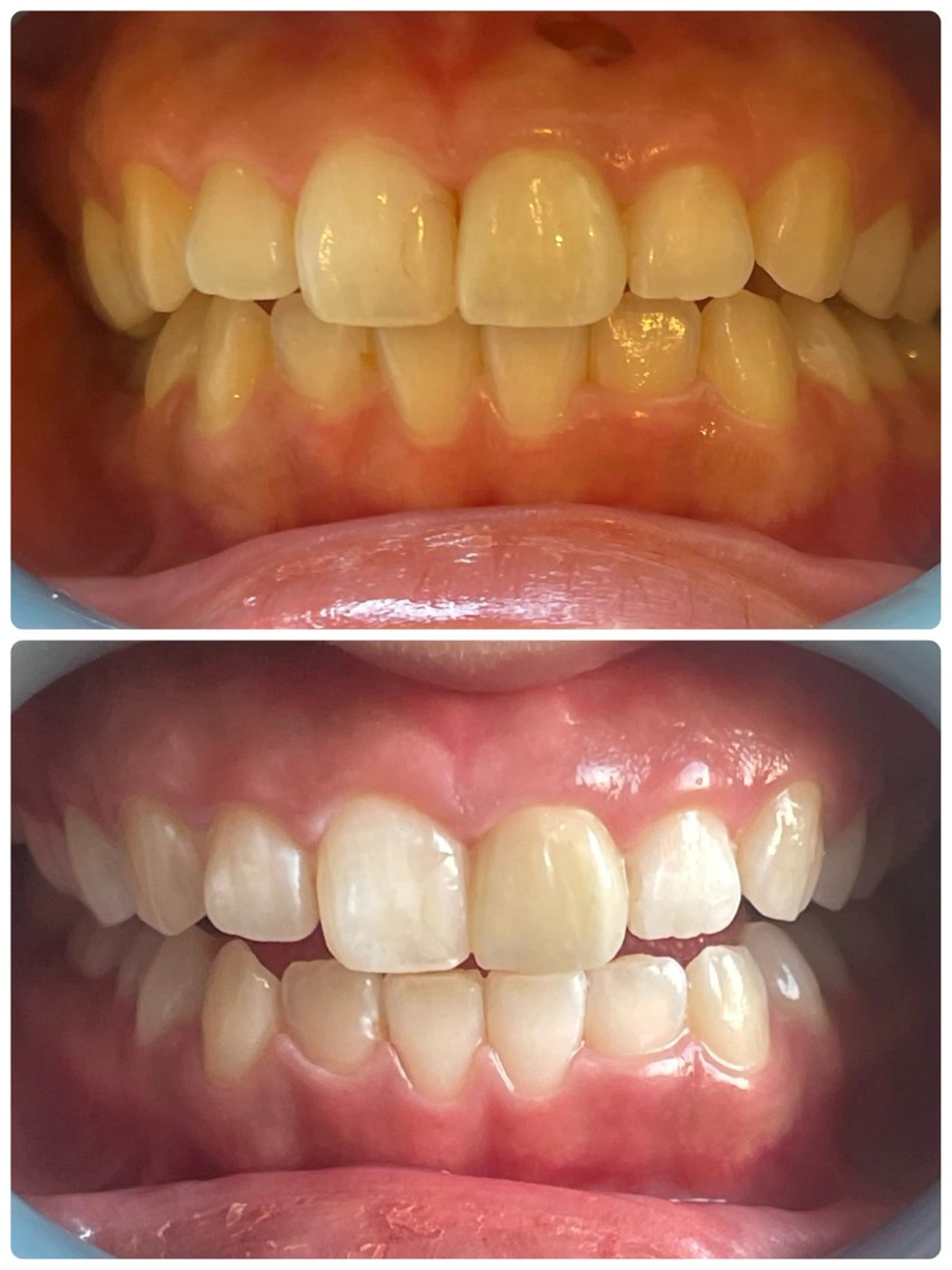 Monreve所属・美人スイッチdiet スーパージェクションのその他イメージ