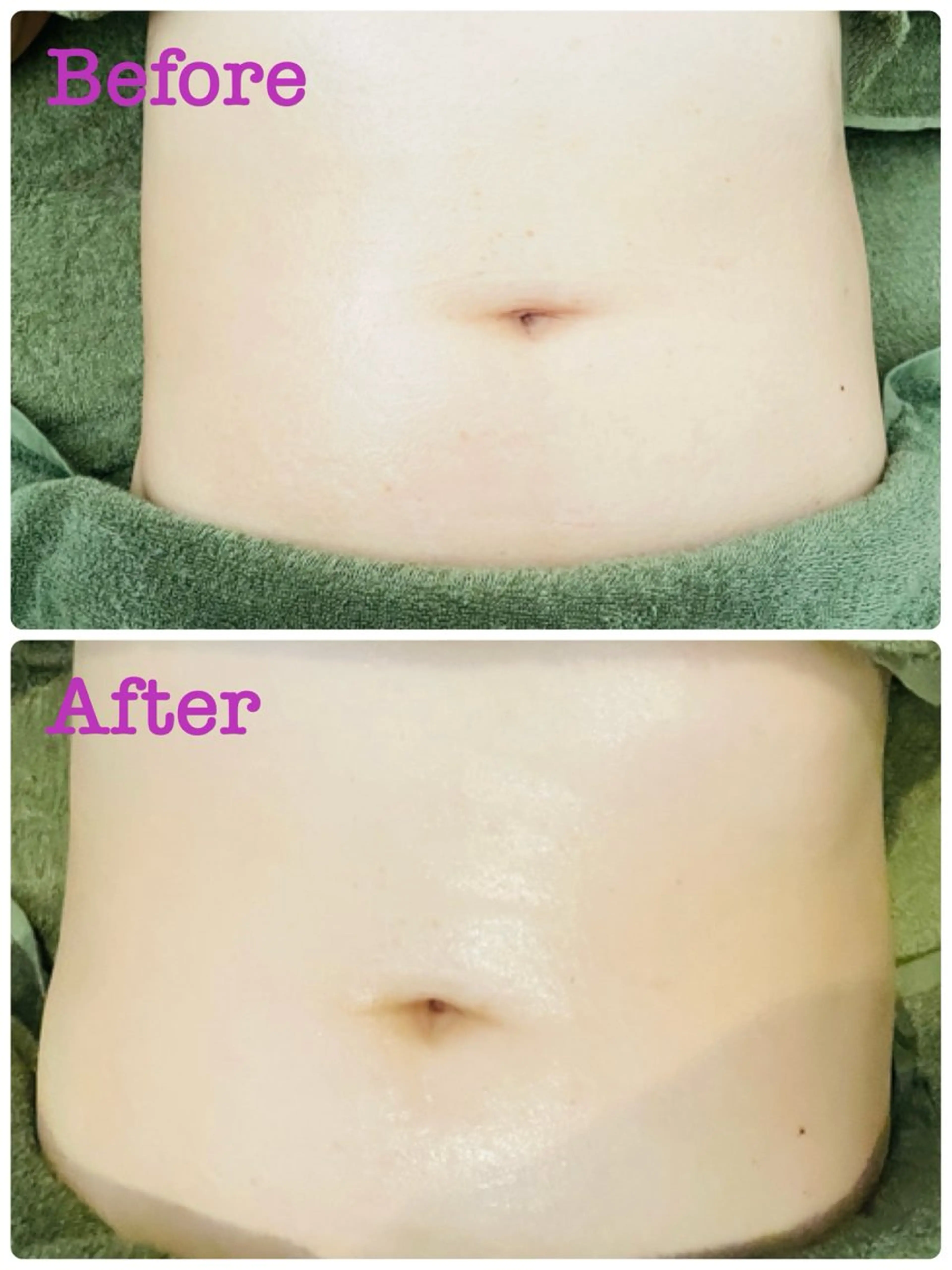 リラクゼーションサロン　Star fort所属・リラクゼーション Star fortのエステ・リラクイメージ