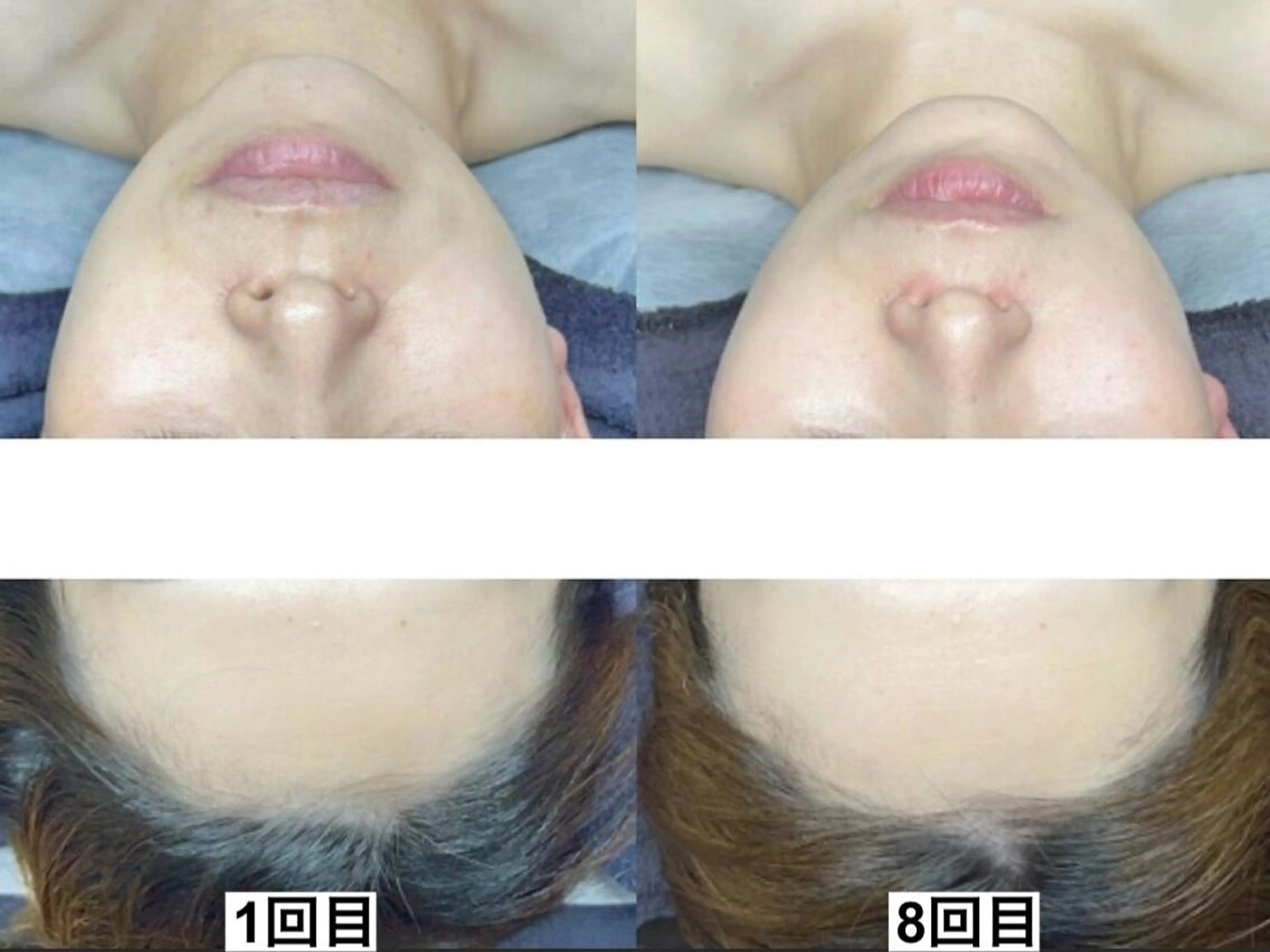 その他 ニキビ・毛穴・肌荒れ &me 西宮北口店のその他イメージ