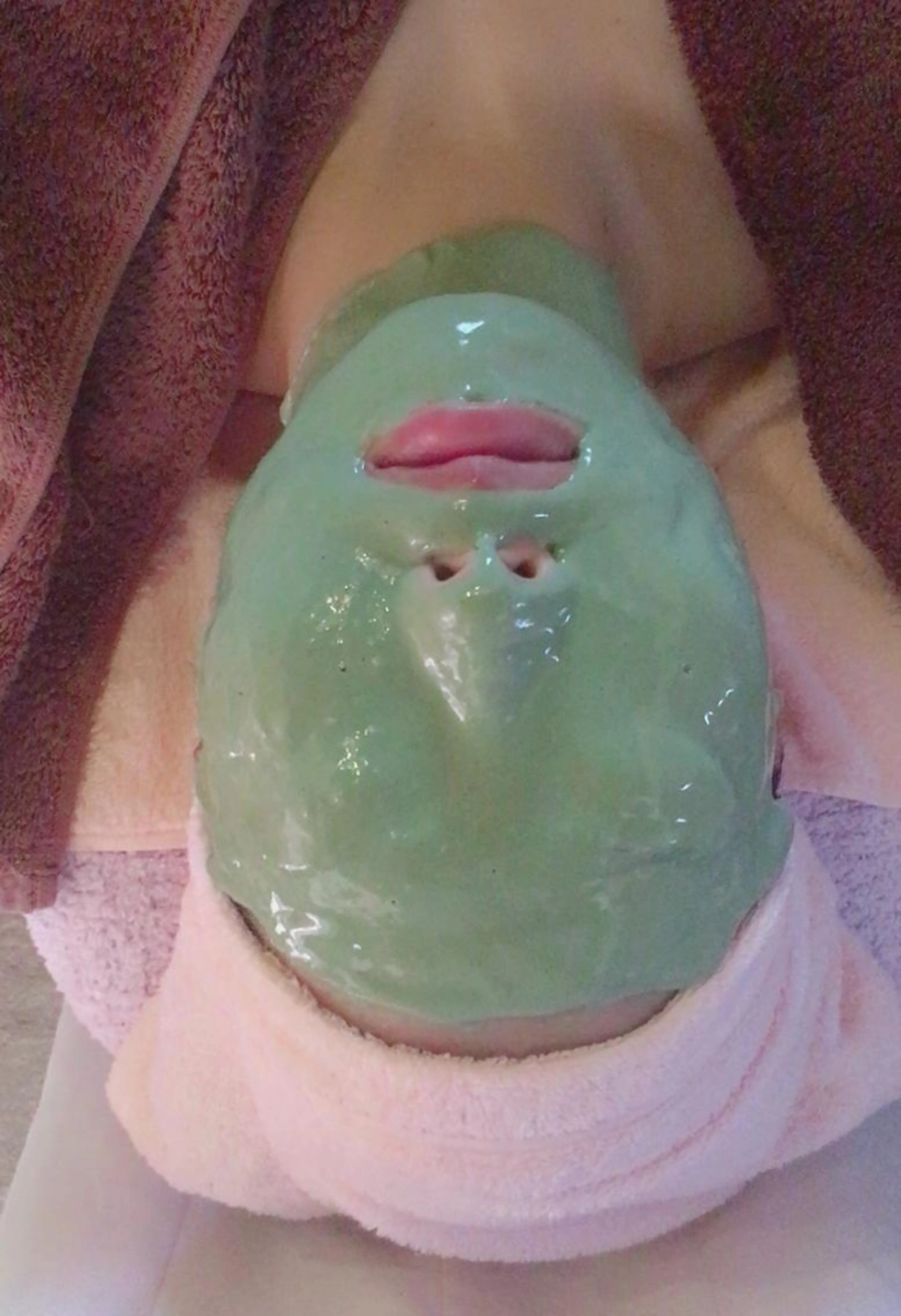 ニキビ.肌荒れ解消フェイシャル(赤みがでやすい方にもオススメ)の写真