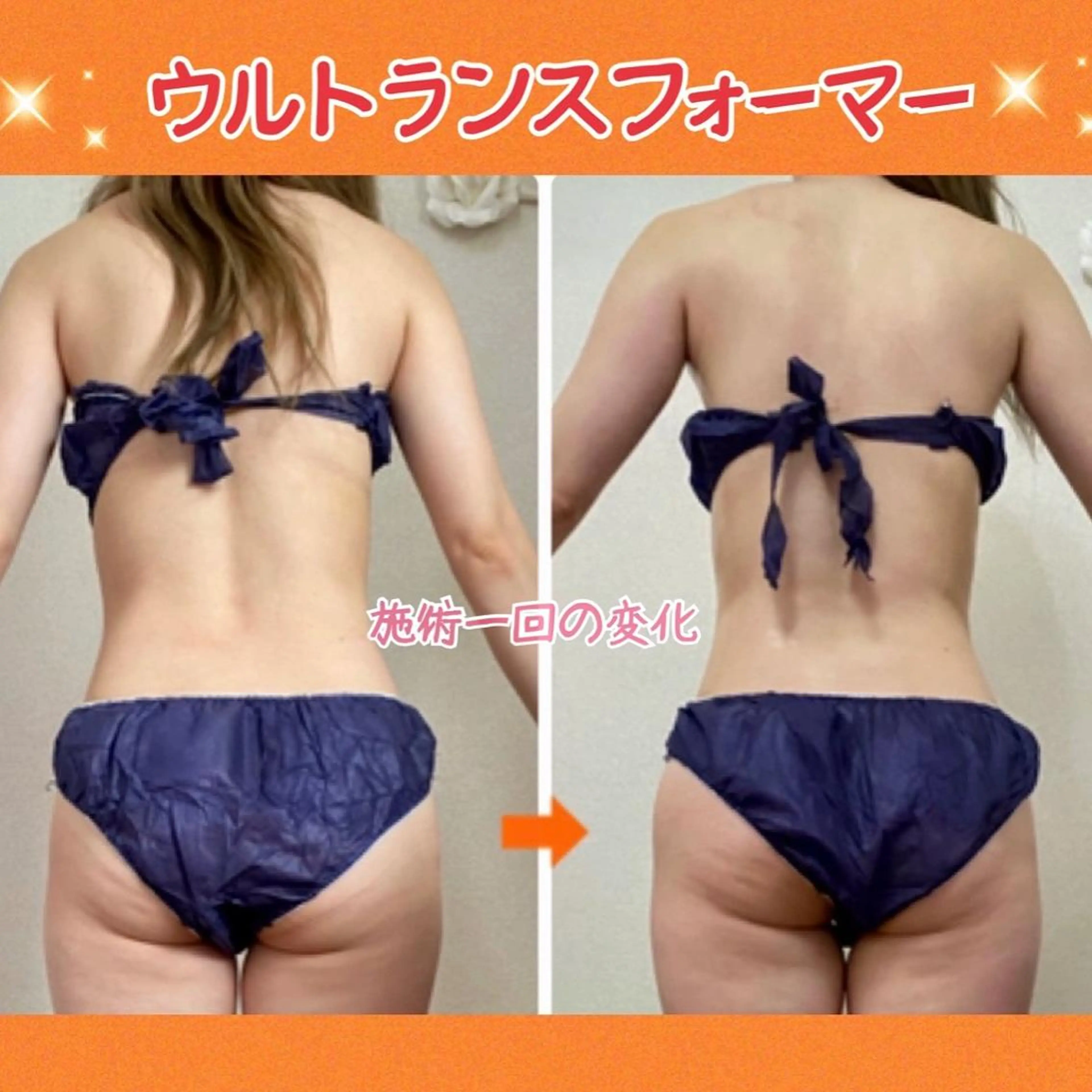 ショート カラー パーマ ヘアアレンジ メンズ キッズ ネイル マツエク・マツパ エステ リラク ‍痩身＆ボディ 結果出し🌟丹野のエステ・リラクイメージ