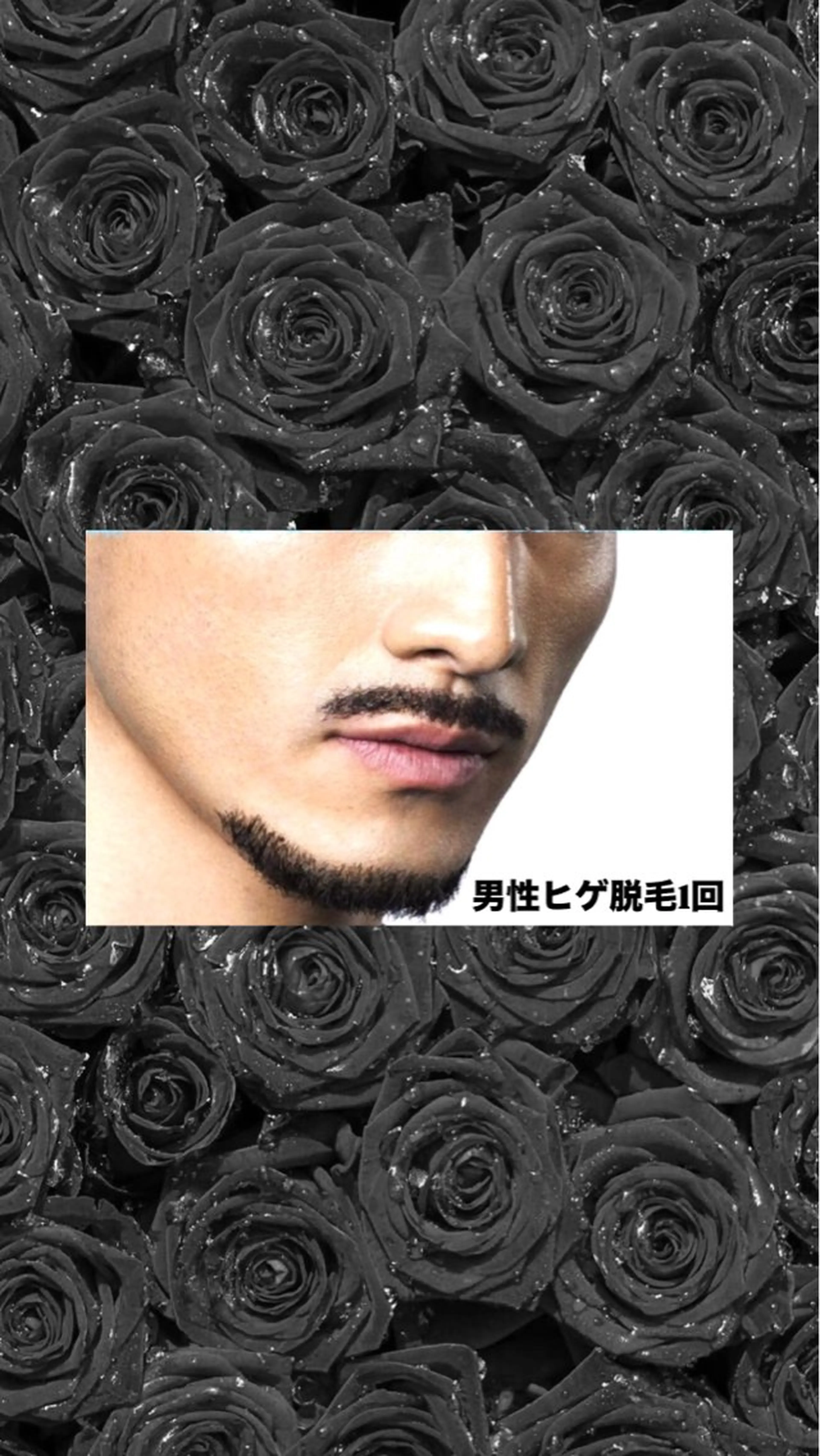 men'sヒゲ🧔🏻‍♂️脱毛1回の写真