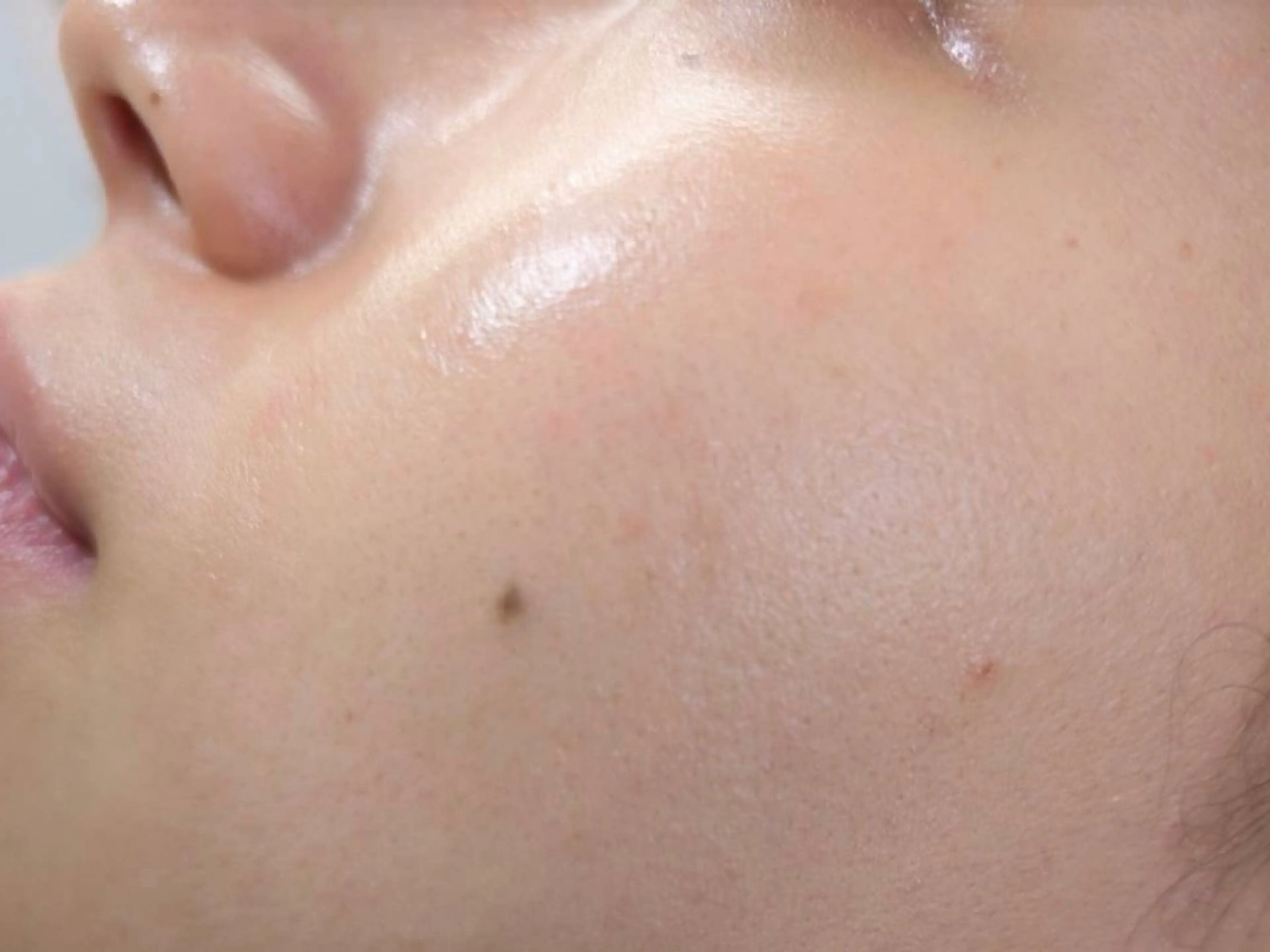 【毛穴のお悩みの方にオススメ🫧】フェイスワックス（沈静高保湿パック付）の写真