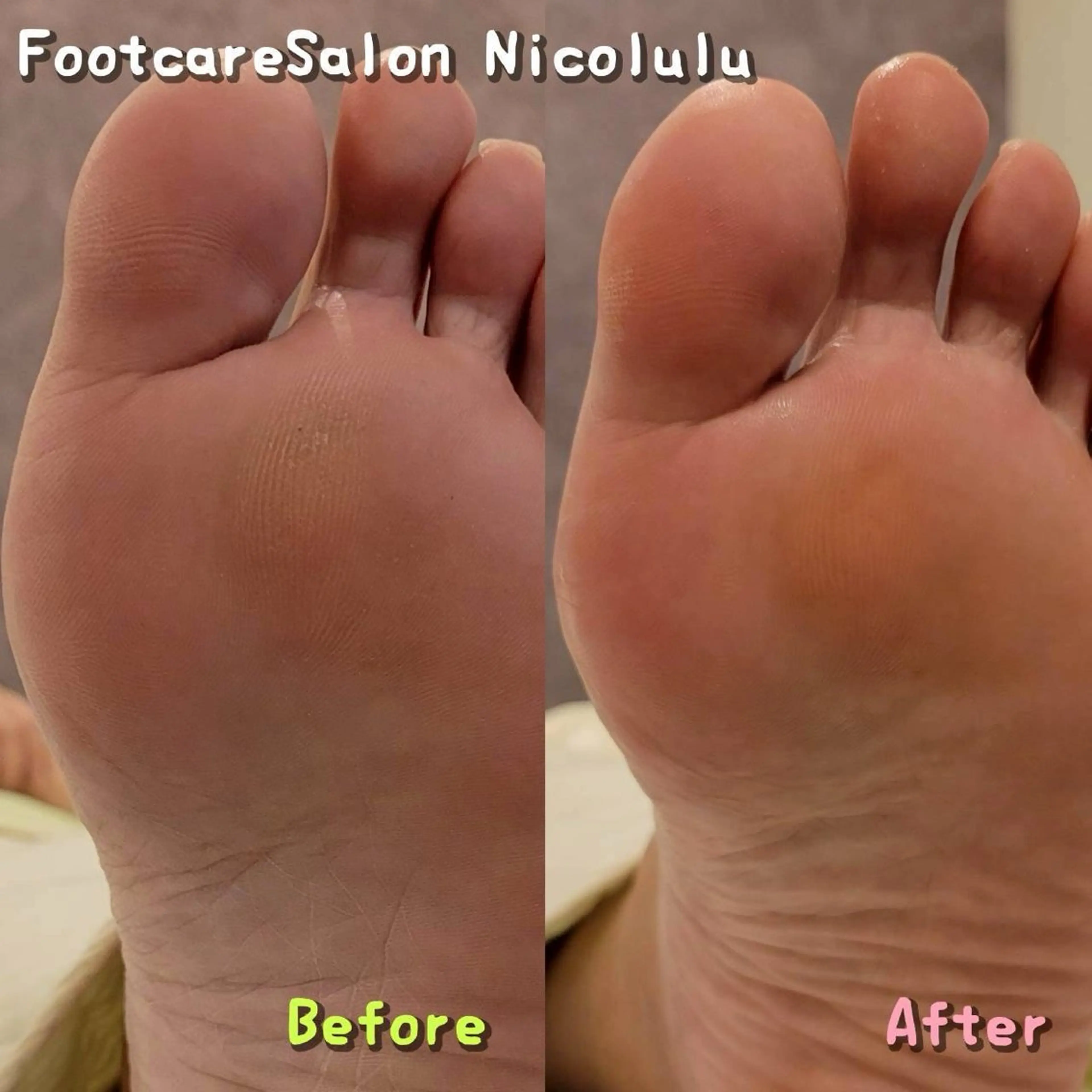 リラク 足トラブル専門 ニコルル金沢のエステ・リラクイメージ