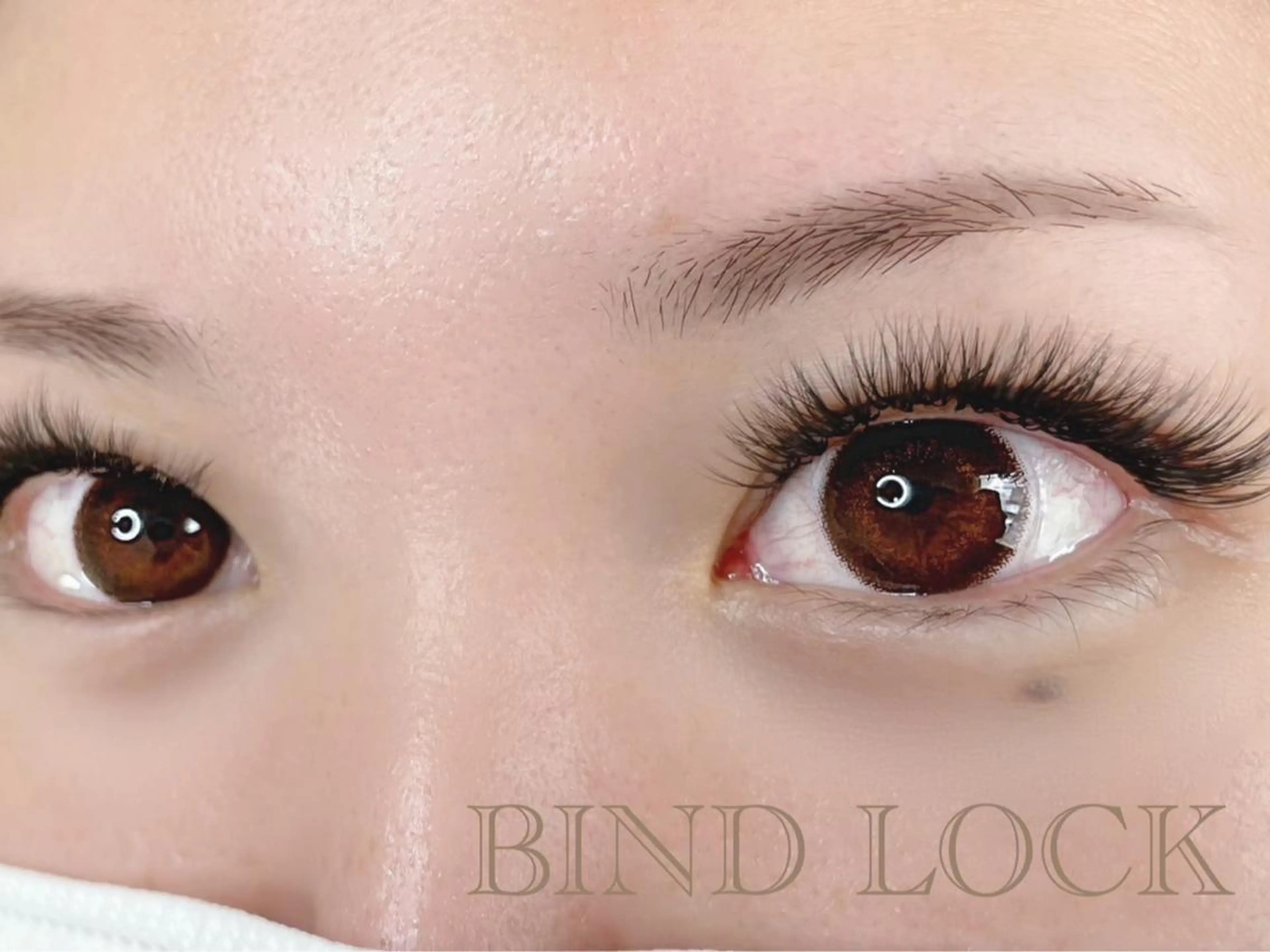 バインドロック120束（オフ込）の写真