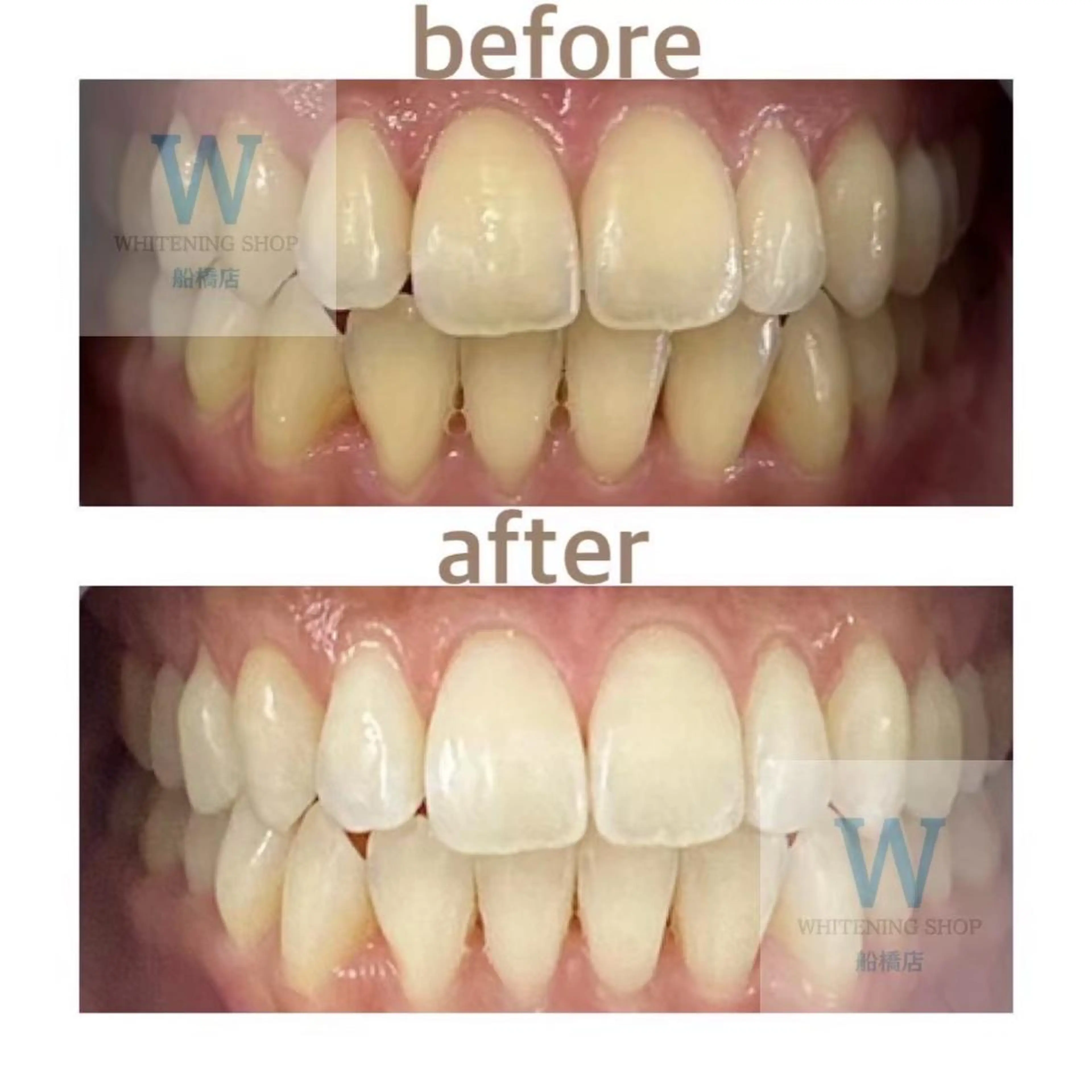 ホワイトニング ショップ船橋２号店のエステ・リラクイメージ