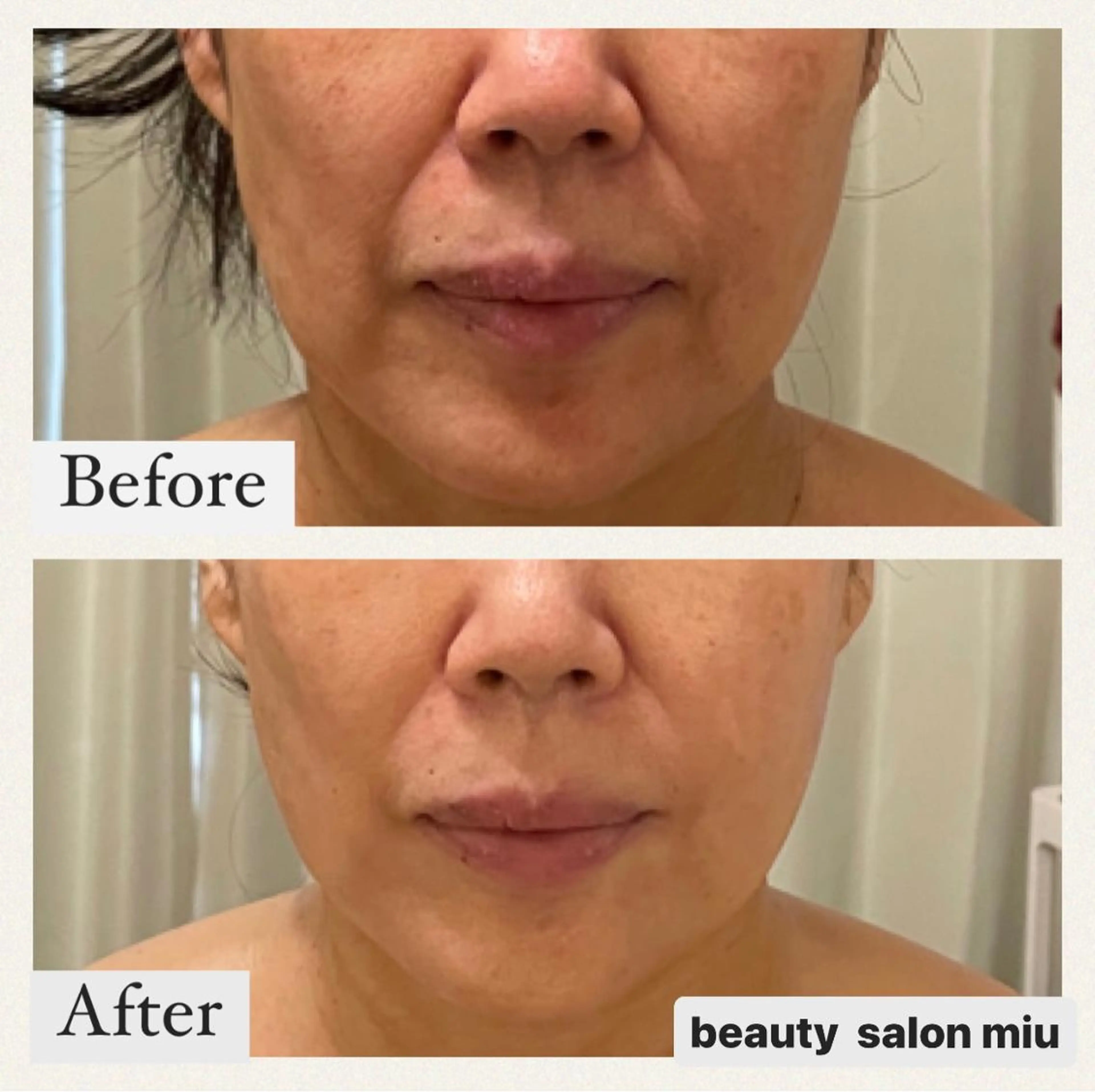 35歳からの エイジングケアサロンのエステ・リラクイメージ