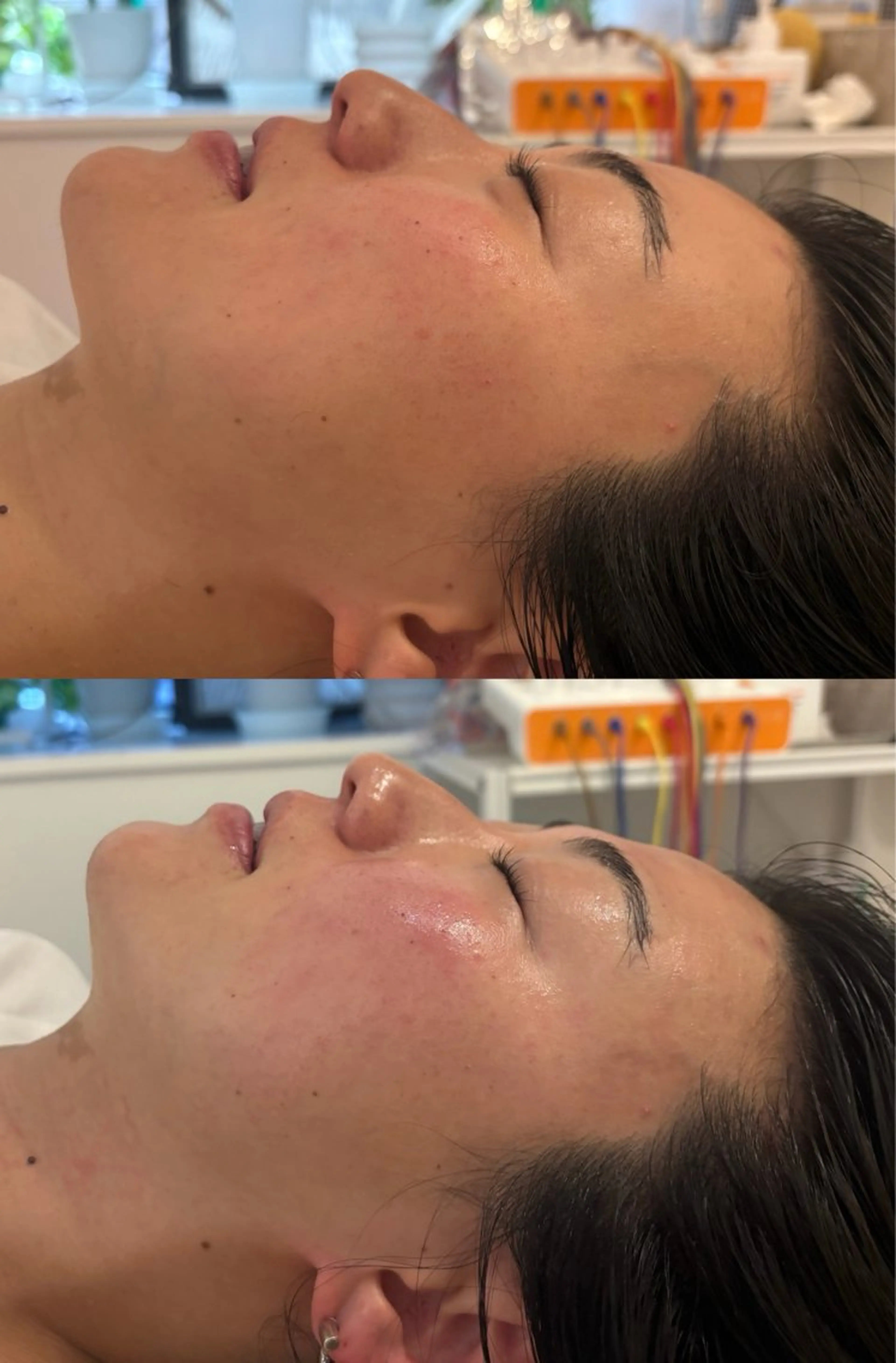 エステ リラク 美容鍼灸サロン mahoroba院長のエステ・リラクイメージ