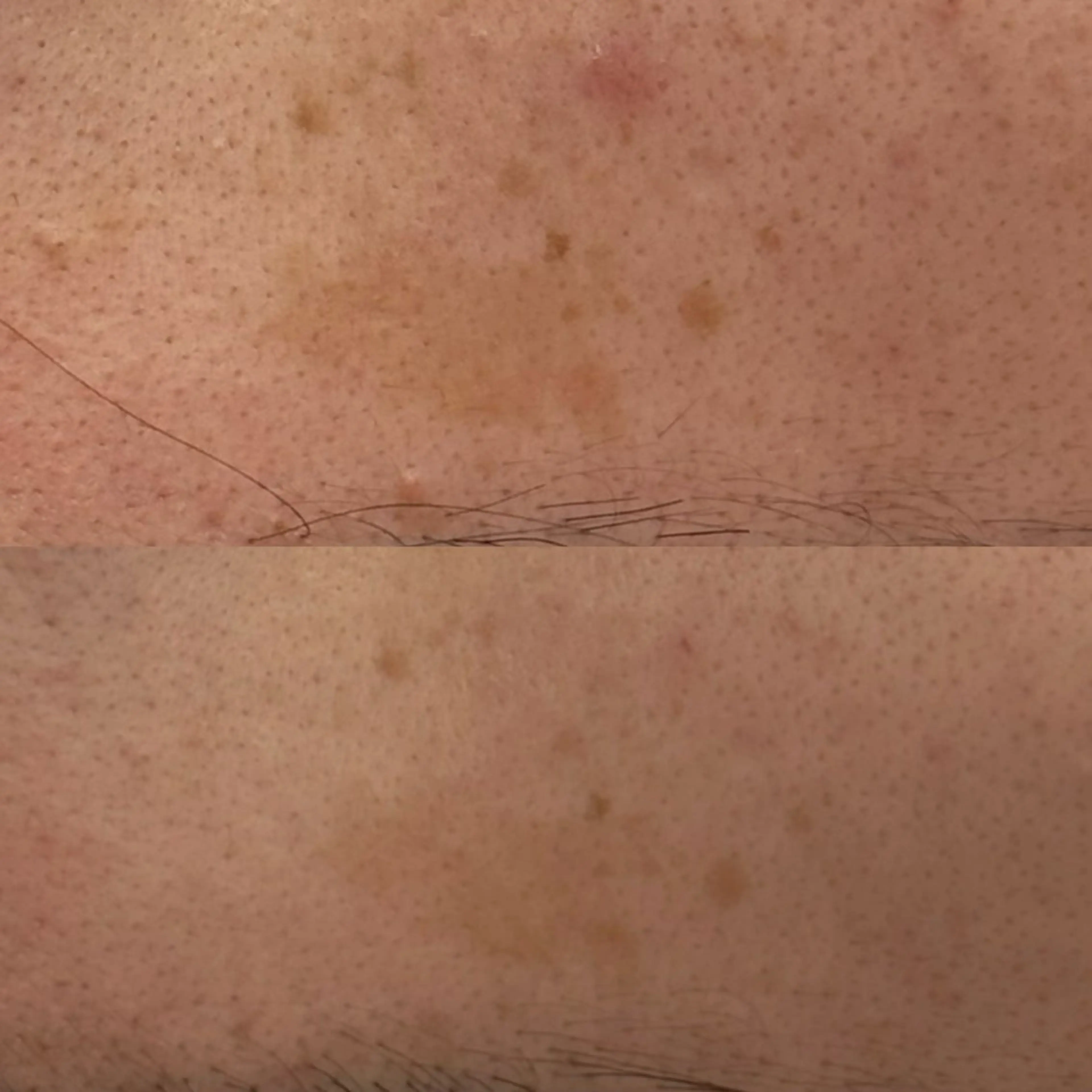 べアール所属・小顔/毛穴/ニキビ salon bealのエステ・リラクイメージ